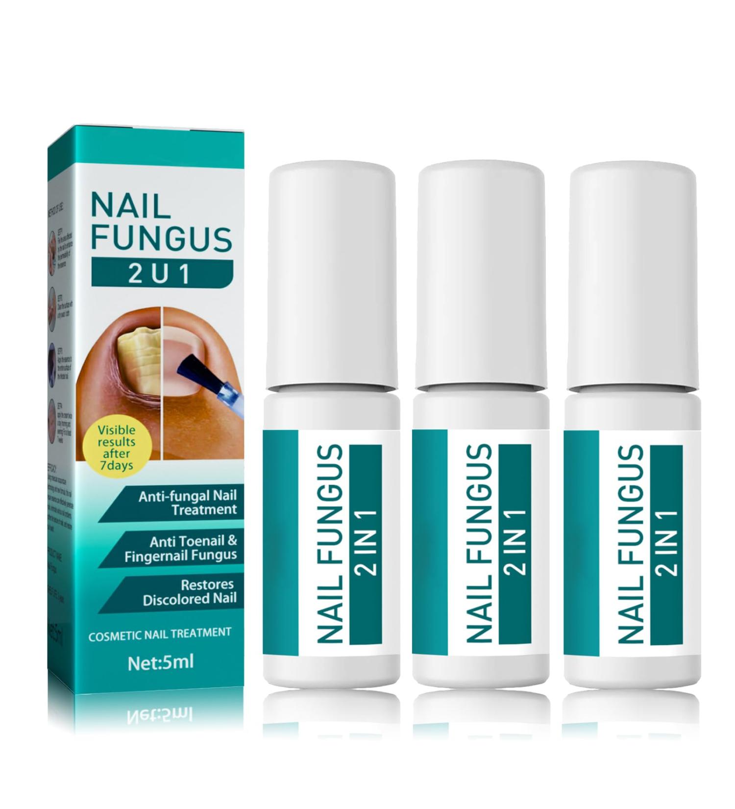 Antifungal Nail Treatment Bundle | Ingrown Toenail Drop | Nail Repair Essence - 3PCS Set for Toe Nail Fungus, Strengthening & Renewing Damaged Nails - Buy Online on GoSupps.com