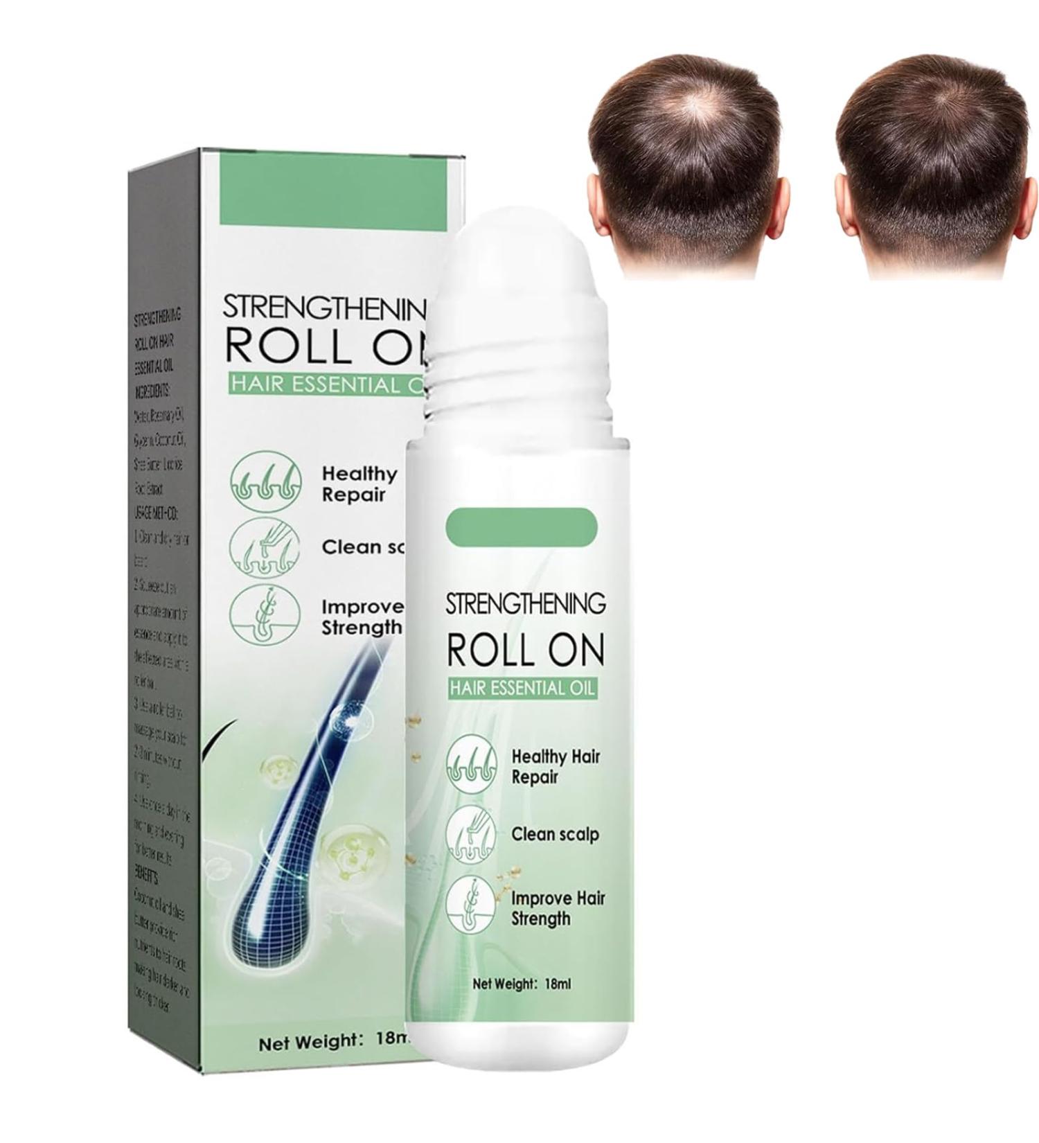 Renew Hair X Renew Hair X Roll-on Hair and Beard Regrow Hair Regrowth Treatment for Hair Loss Hair and Beard Regrowth Roll-on Serum for Men and Women (1 pc) - Buy Online on GoSupps.com