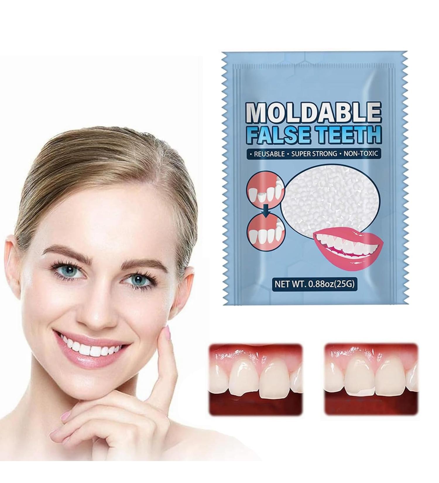 Provisional Dentures & Temporary Tooth Repair Set - Vampire Fake Dentures | International Shipping - Buy Online on GoSupps.com