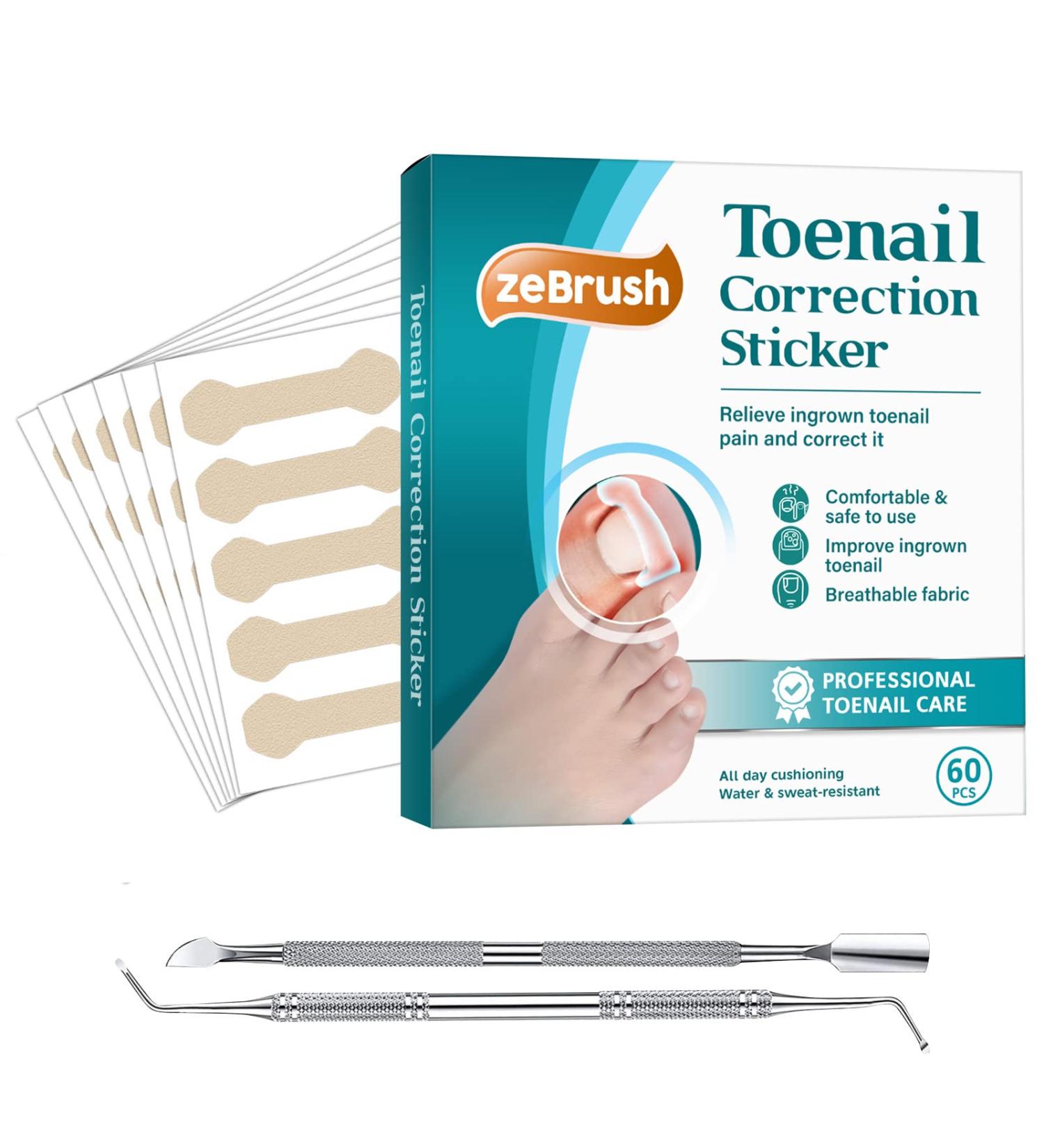 Professional Ingrown Toenail Treatment Kit - 60PCS Toenail Corrector Strips, File, and Lifter - Painless Pedicure Tool for Ingrown Toenails - Buy Online on GoSupps.com