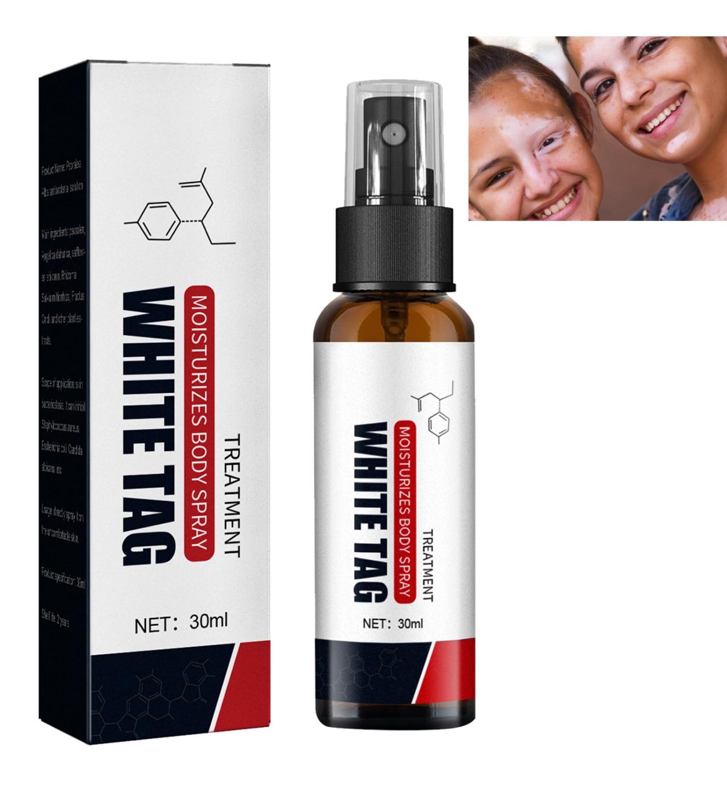 KOAHDE Psoriasis Treatment Spray Vitiligo Relief Spray Psoriasis Control Face and Body Cream Soothing and Moisturizing Coal Tar Psoriasis Cream Spray Psoriasis Control White Spot Spray 30ml 1PC - Buy Online on GoSupps.com