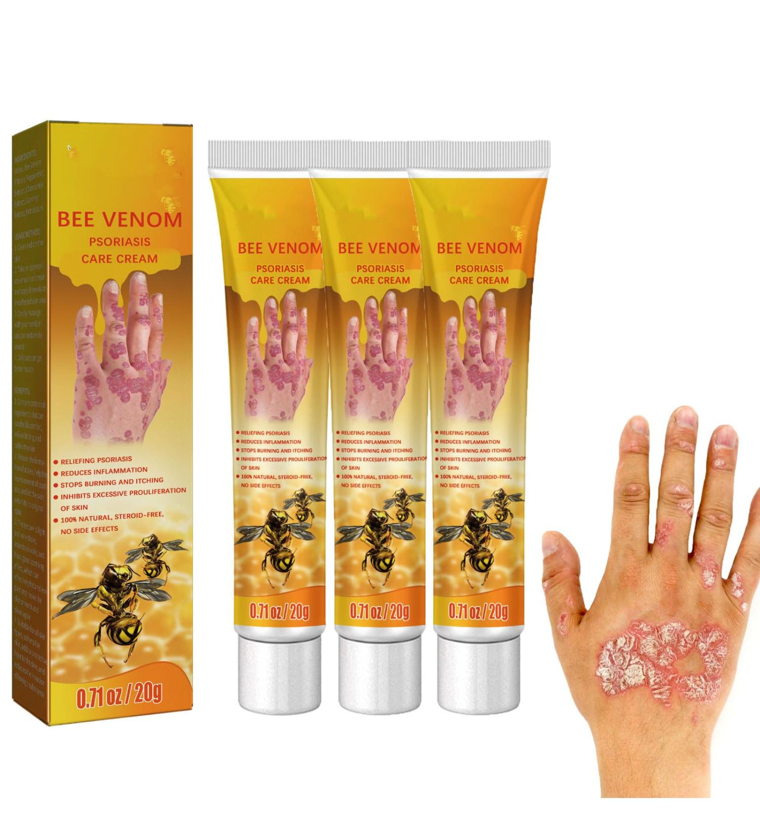 UPiKIT Bee Venom Psoriasis Treatment Cream - 20g/pc (3pcs) - For All Skin Types - Buy Online on GoSupps.com