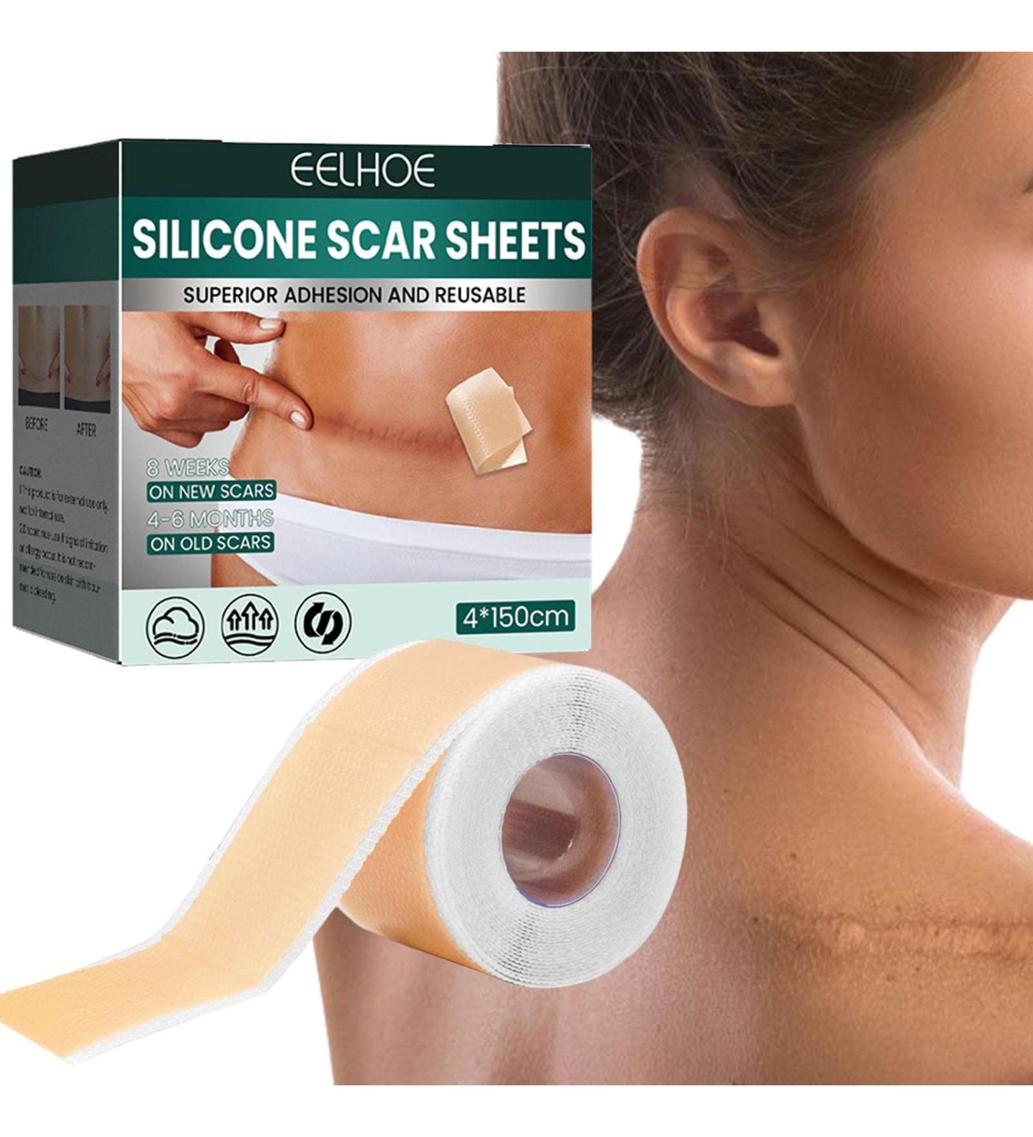 Teksome Silicone Scar Sheets - Stretch Mark Remover | Soften & Flatten Scars | For Surgery Injury Burns C-Section | 1.57*59 Inches - Buy Online on GoSupps.com