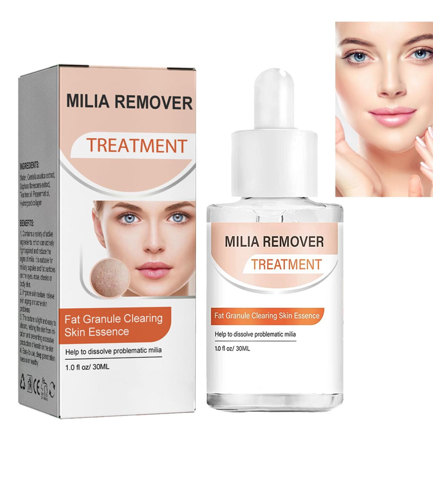 Fat Granule Clearing Skin Essence Milia Clearing Essence Milia Remover Serum Organic Skin Spot Purifying Serum Milia Spot Removal Treatment Helps Dissolve and Reduce Milia - Buy Online on GoSupps.com