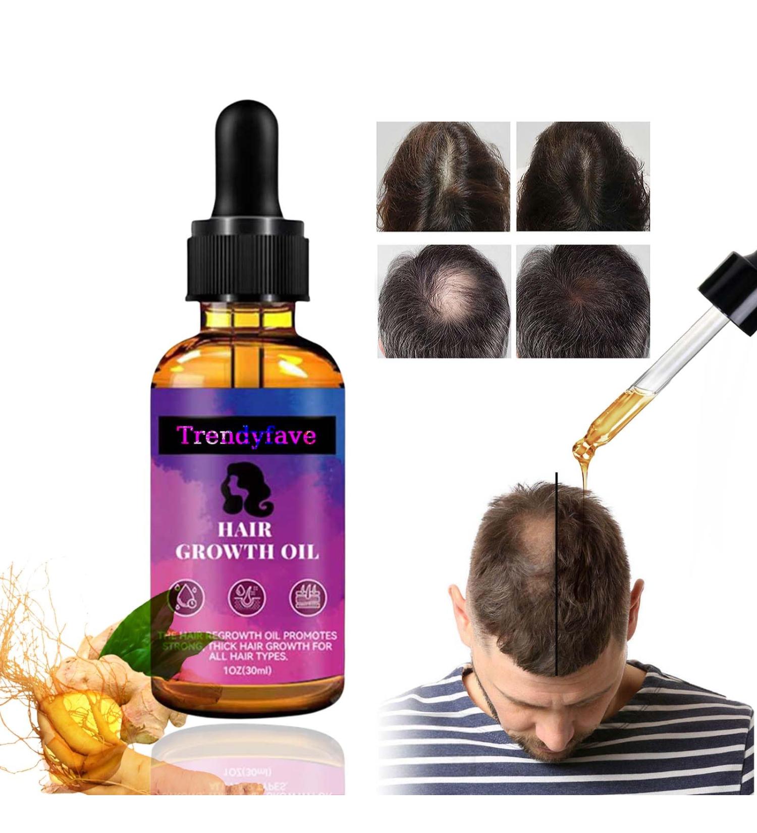 Trendyfave Hair Growth Serum Vitamins Serum for Hair Loss and Hair Regrowth Ginger Oil for Hair Growth for Balding Thinning Repairs Hair Follicles Natural Herbal Hair Growth Oils for Men and Women - Buy Online on GoSupps.com