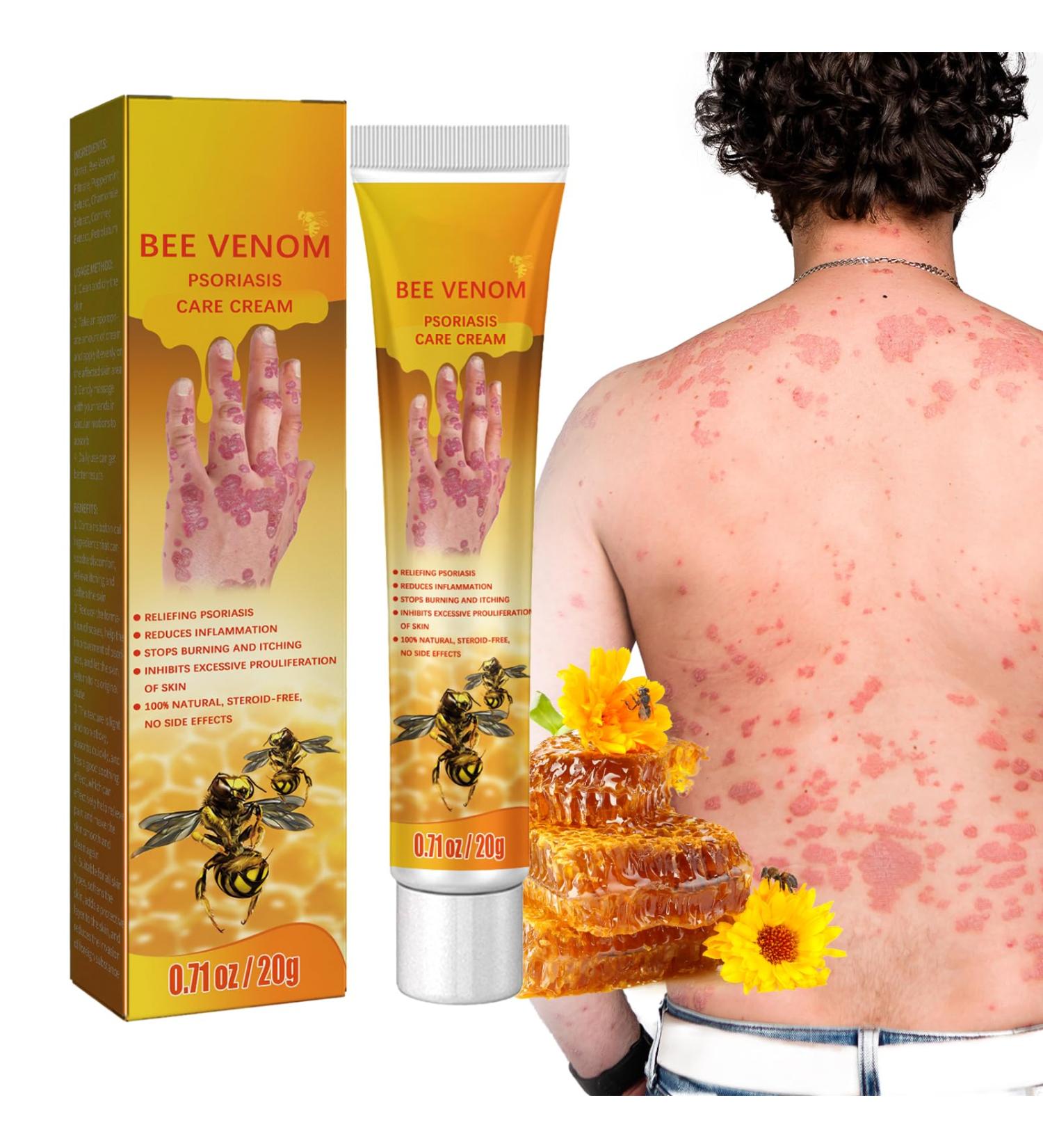 Yanolam Youth Bee Venom Psoriasis Treatment Cream - Soothing & Moisturizing Professional Care from New Zealand (1) - Buy Online on GoSupps.com