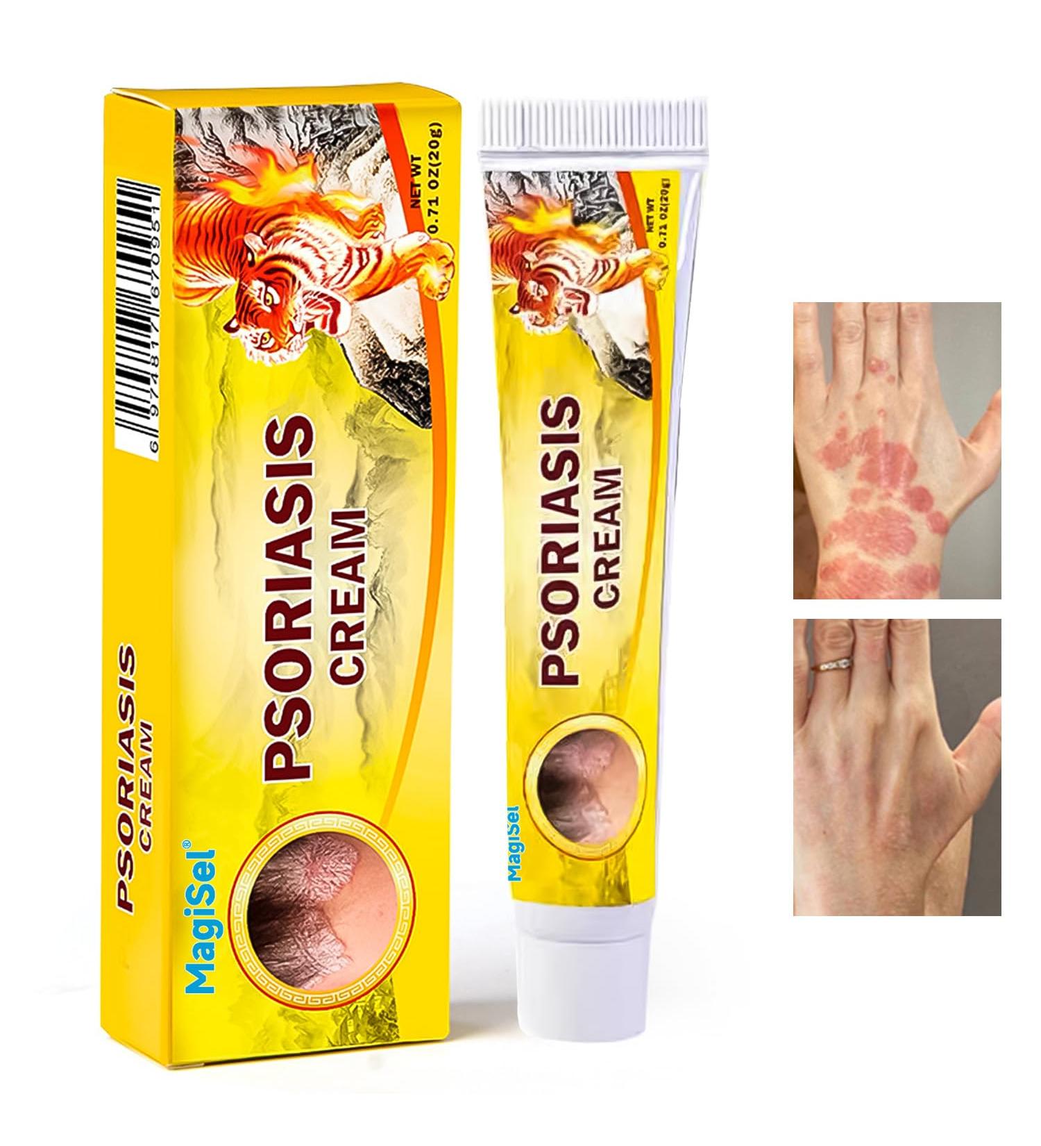  MagiSel Anti-itch ointment soothing skin cream for itching and psoriasis natural care formula skin cream cares for and soothes the skin non-irritating (20 g) - Buy Online on GoSupps.com