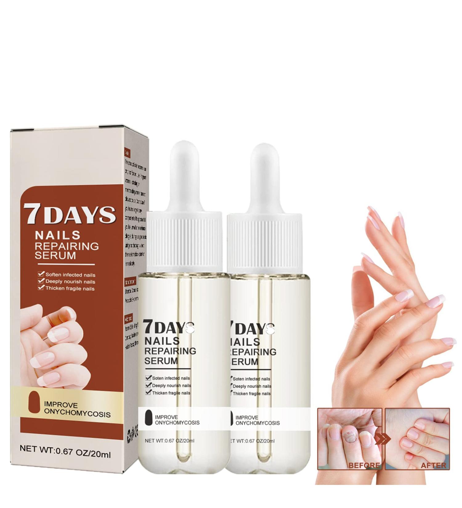 2Pcs Nail Repair Serum Set | 7 Days Growth & Strengthening Solution | Cuticle Oil Strengthener for Damaged Nails - Buy Online on GoSupps.com