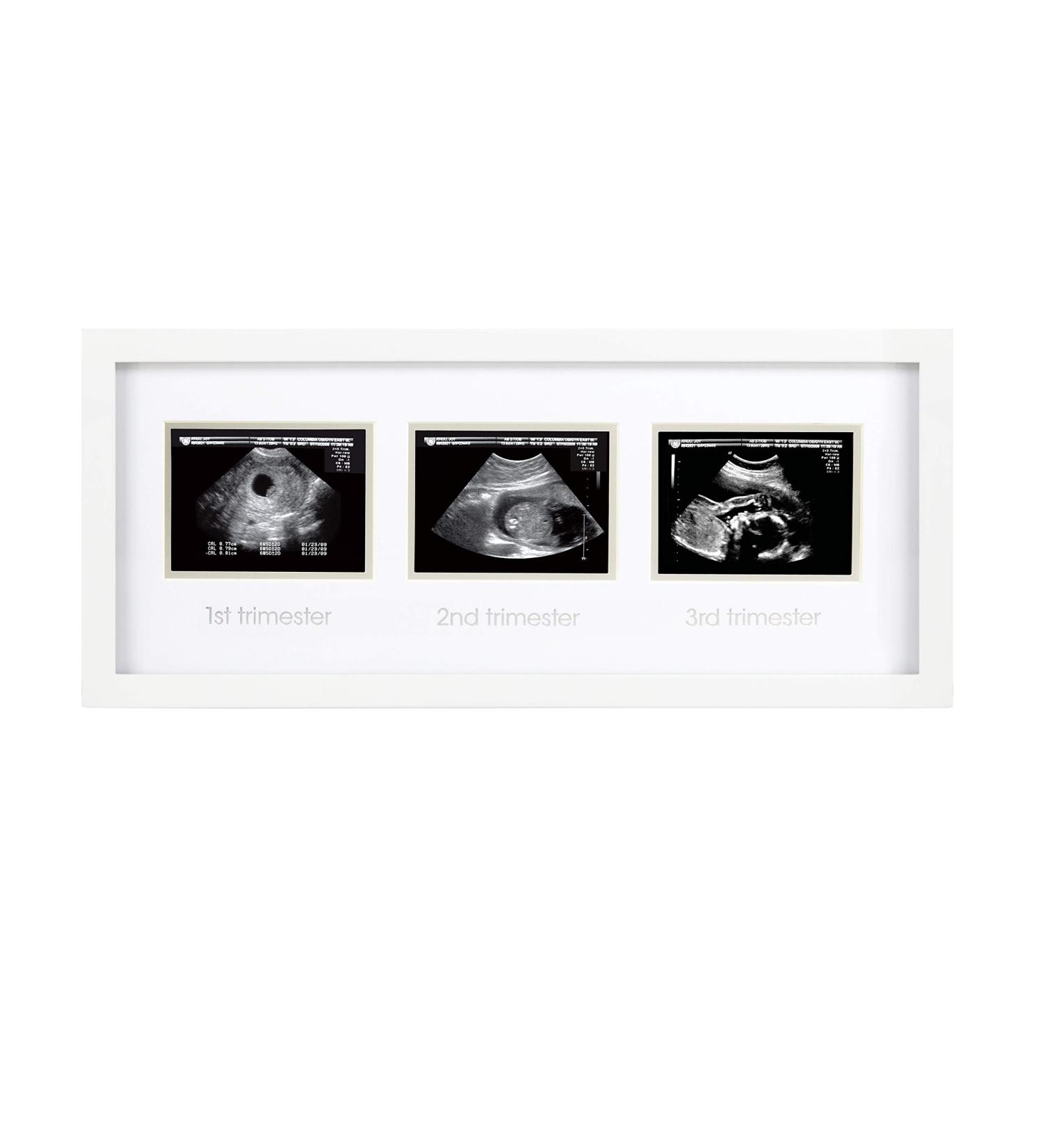 Pearhead Trimester Progression Sonogram Picture Frame - Gender-Neutral Pregnancy Milestone Keepsake for Baby Nursery D cor - Ideal Mother's Day Gift - Buy Online on GoSupps.com