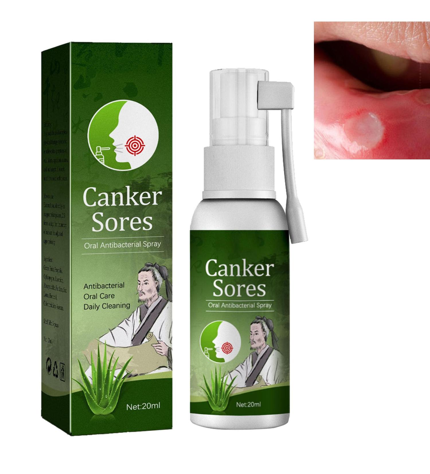 Spray de Soulagement Ulc res Spray Pour Ulceres Buccaux Spray Soins Ulc res Buccale Spray de Soulagement Ulc res Buccaux Traitement des Ulc res de la Bouche Spray Contre Ulc re Buccal 1PC - Buy Online on GoSupps.com