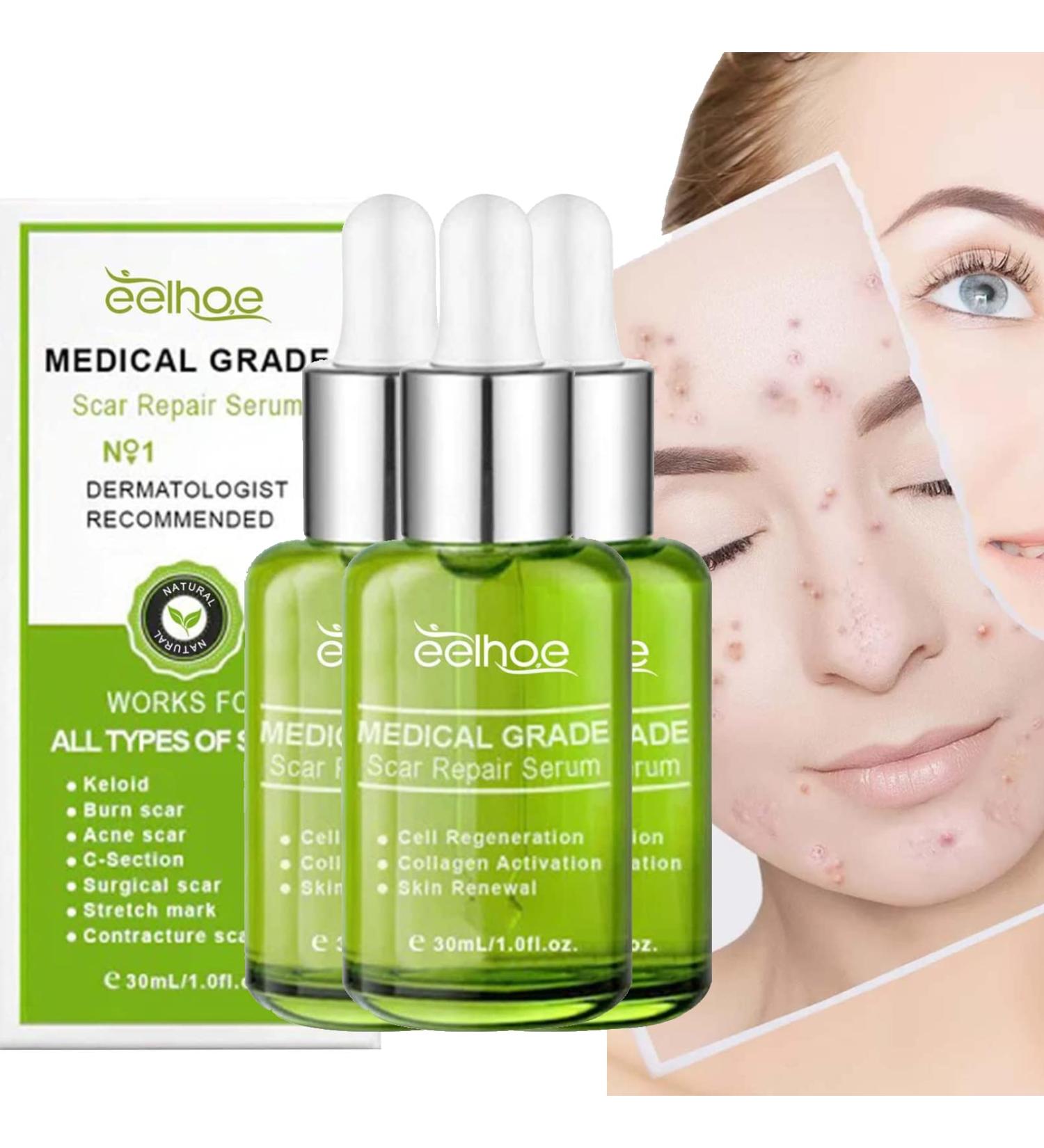 Goopgen Advanced Scar Repair Serum - Effective Treatment for Surgical Scars, Stretch Marks, Acne, Burns - Smooth & Repair Skin - 3PC Set - Buy Online on GoSupps.com
