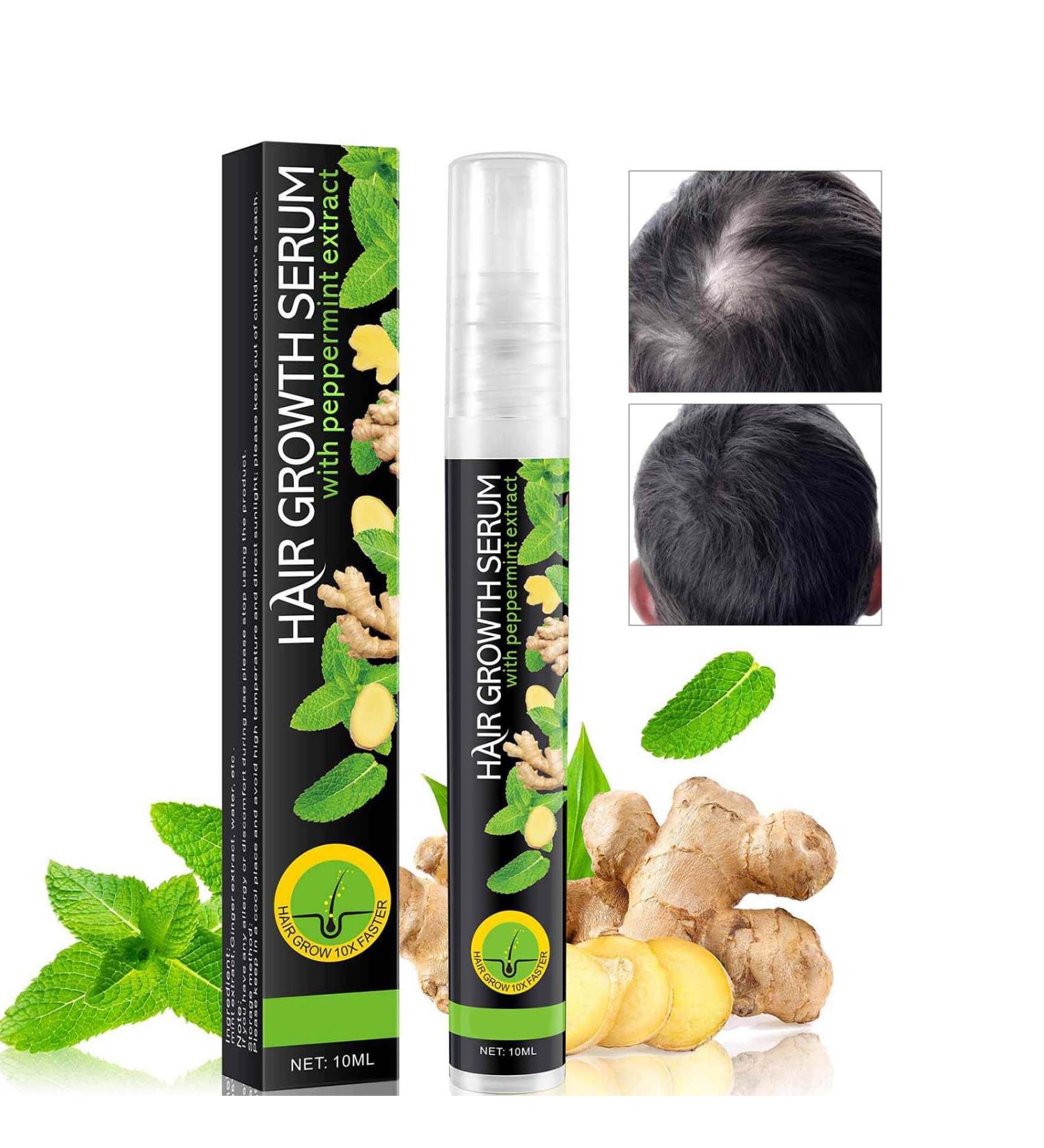Hair Regrowth Spray Hair Growth Serum for Men & Women Anti Hair Loss Spray with Mint and Ginger Hair Rapid Growth Spray Repair Hair Follicles Hair Regrowth Serum for Bald Spots & Thinning Hair - Buy Online on GoSupps.com
