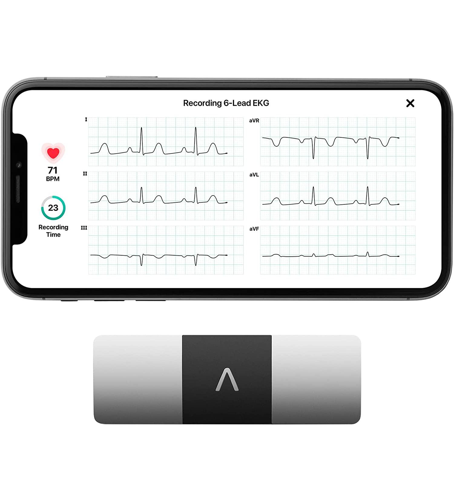 KardiaMobile 6-Lead EKG Monitor - Detect AFib & Arrhythmias - Instant Results - FSAHSA Eligible - Buy Online on GoSupps.com