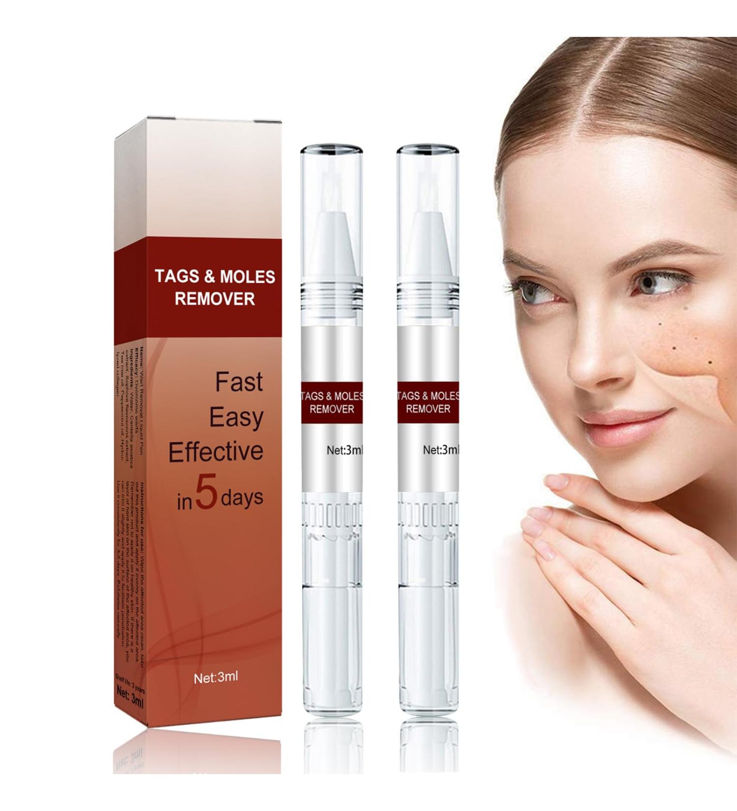 Wipe Off Moles & Skin Tags Remover Pen - Natural, Non-Irritating Formula for Easy Removal on Face & Body (2 PCS) - Buy Online on GoSupps.com