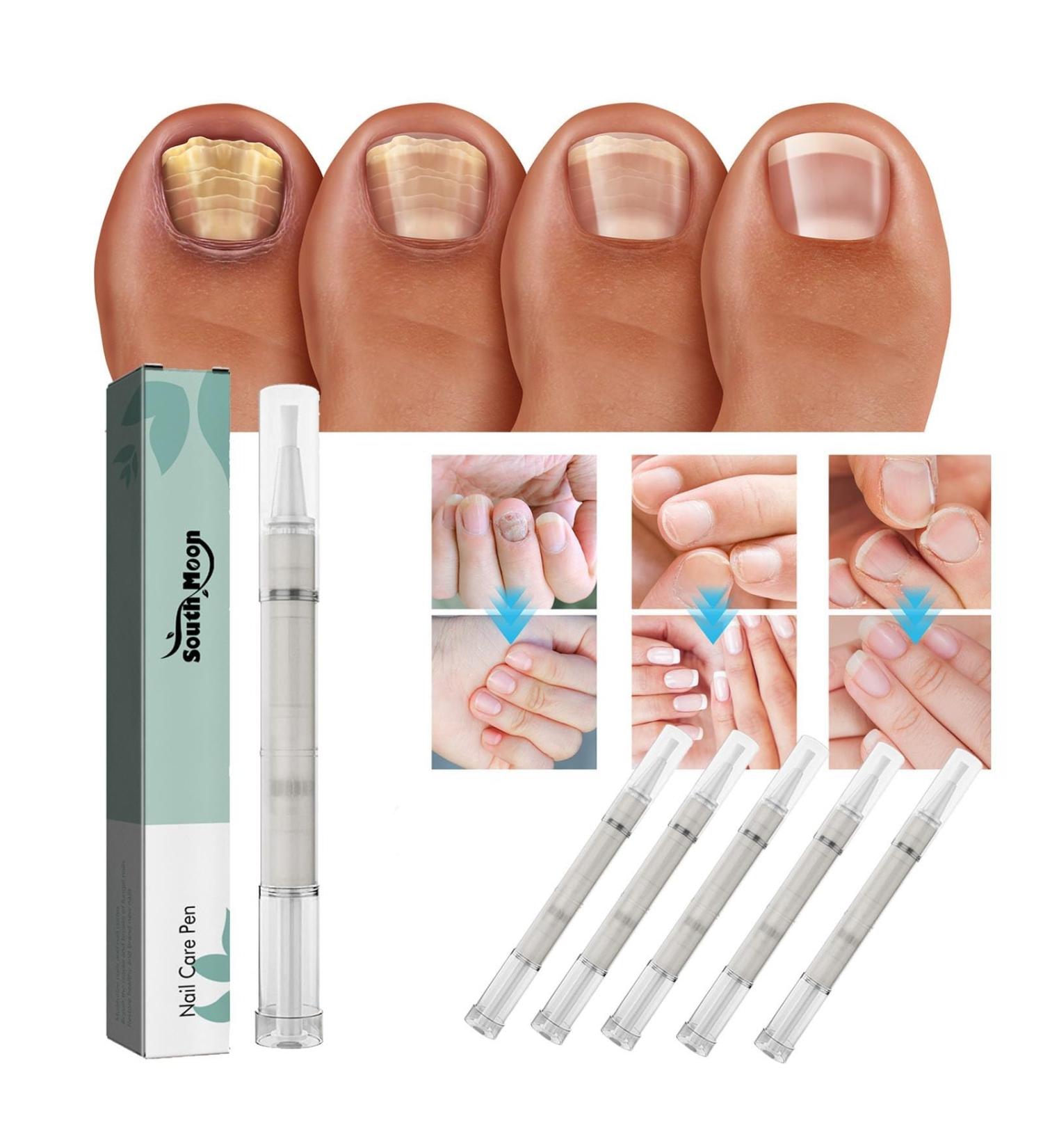 5-Piece Nail Care Pen Set | Nail Repair Treatment with Tea Tree Oil Vitamin E & Aloe Vera for Healthy Fingernails & Toenails - Buy Online on GoSupps.com