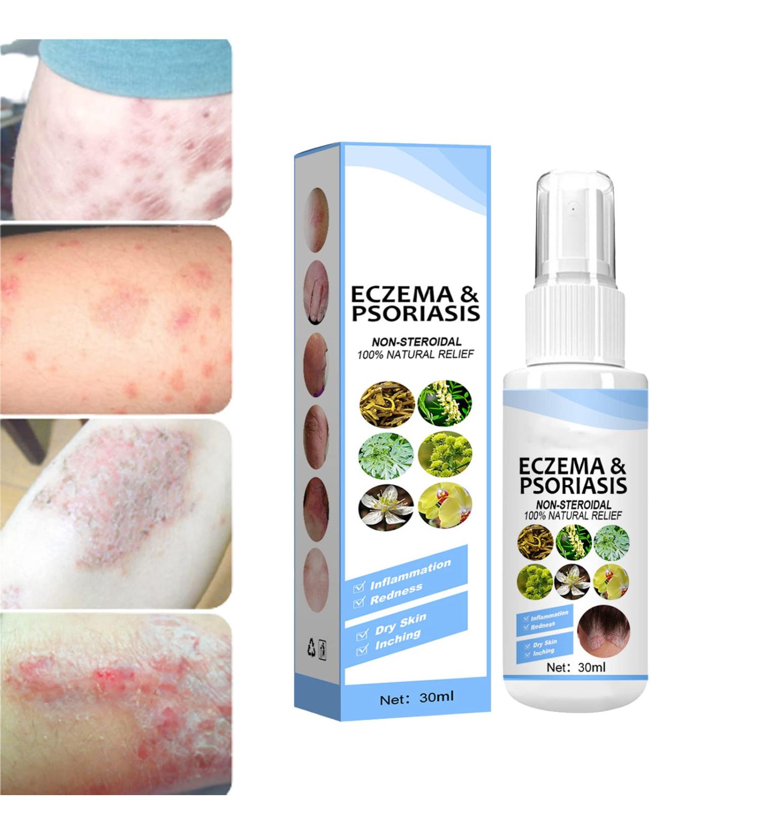 DUBUSH Meellop Herbal Psoriasis Relief Spray - Eczema & Psoriasis Treatment - Soothing & Moisturizing - 3PCS - Buy Online on GoSupps.com