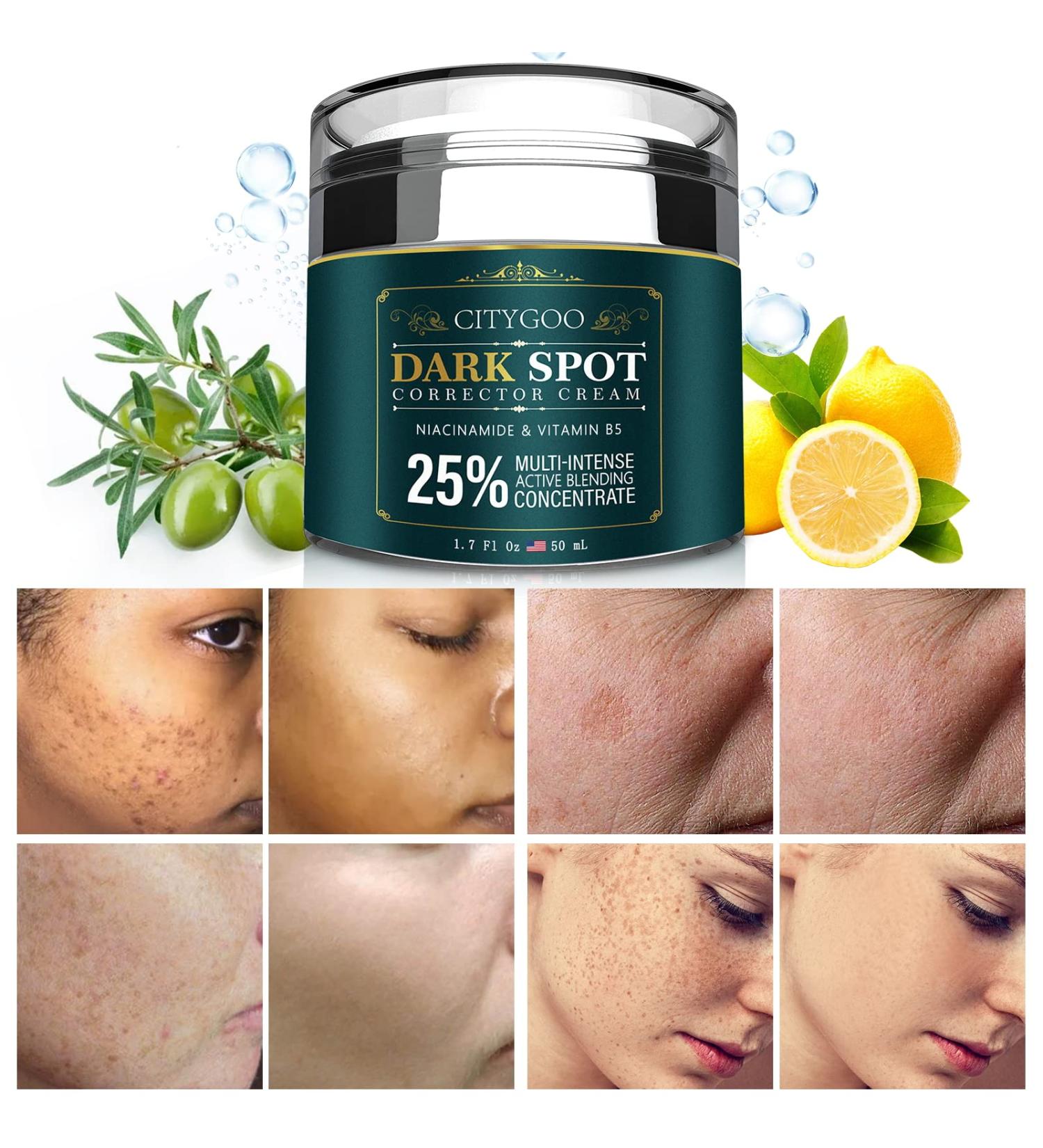 CITYGOO Dark Spot Remover Cream for Face and Body - Natural Ingredients for Melasma, Freckles, Sun Spots - 1.7 FL OZ - Buy Online on GoSupps.com