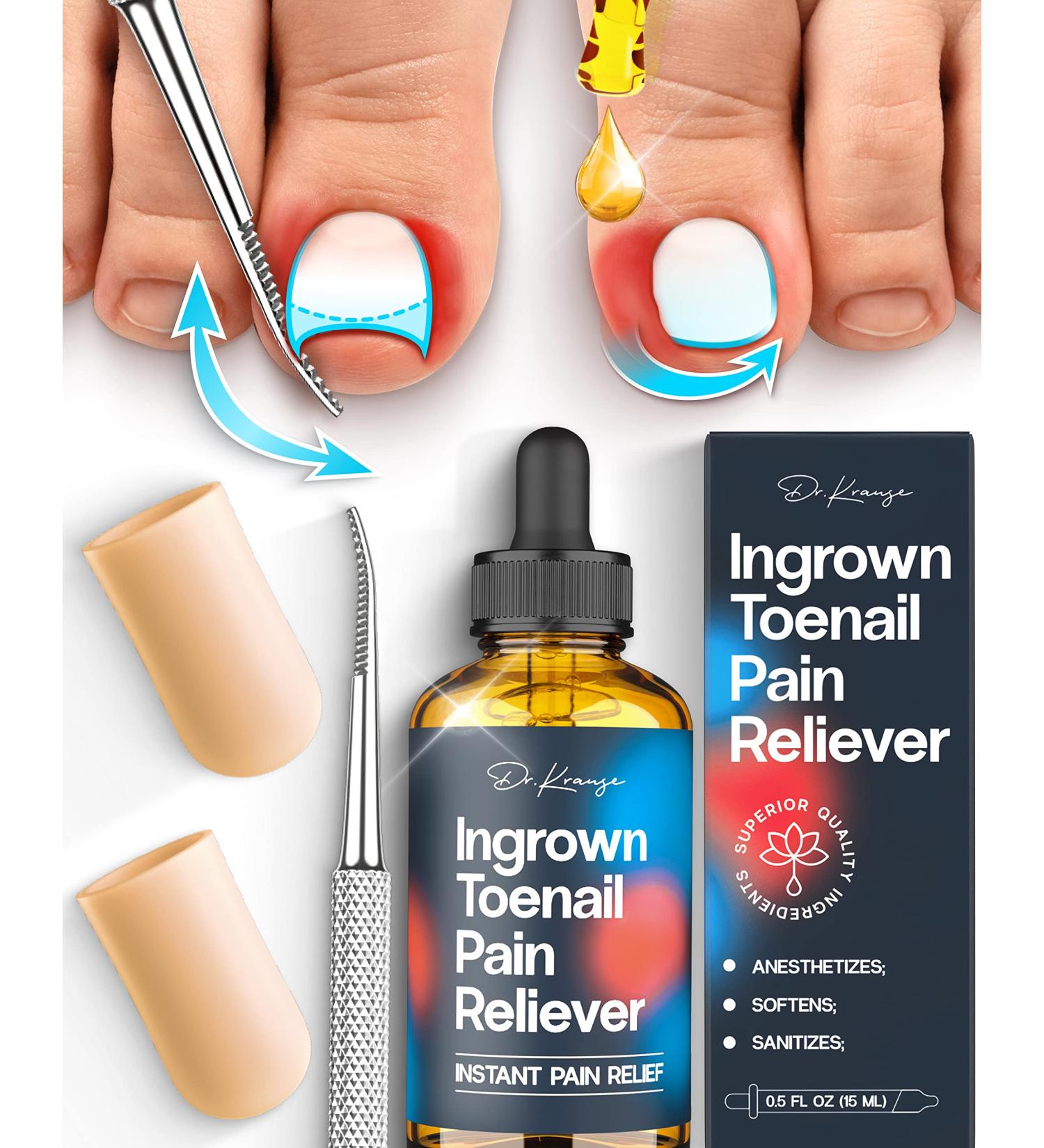 Dr. Krause Ingrown Toenail Treatment Kit - Gel Toe Caps, File, Pain Reliever, Softener - Tea Tree Oil Drops - Buy Online on GoSupps.com