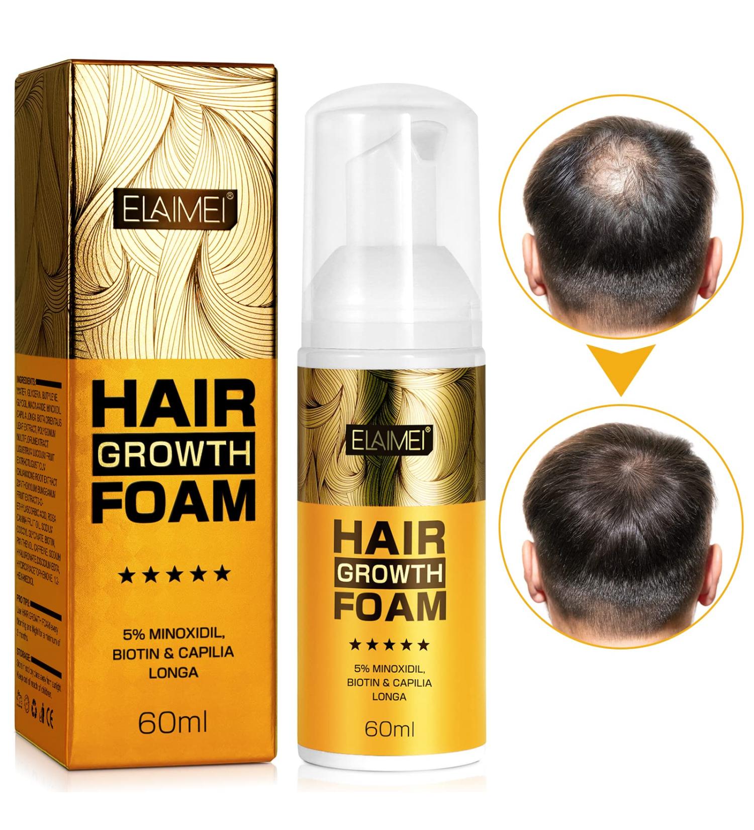 5% Minoxidil Foam Hair Regrowth Treatment for Men & Women - Stops Hair Loss, Promotes Follicle Growth - 2.11fl oz - Buy Online on GoSupps.com