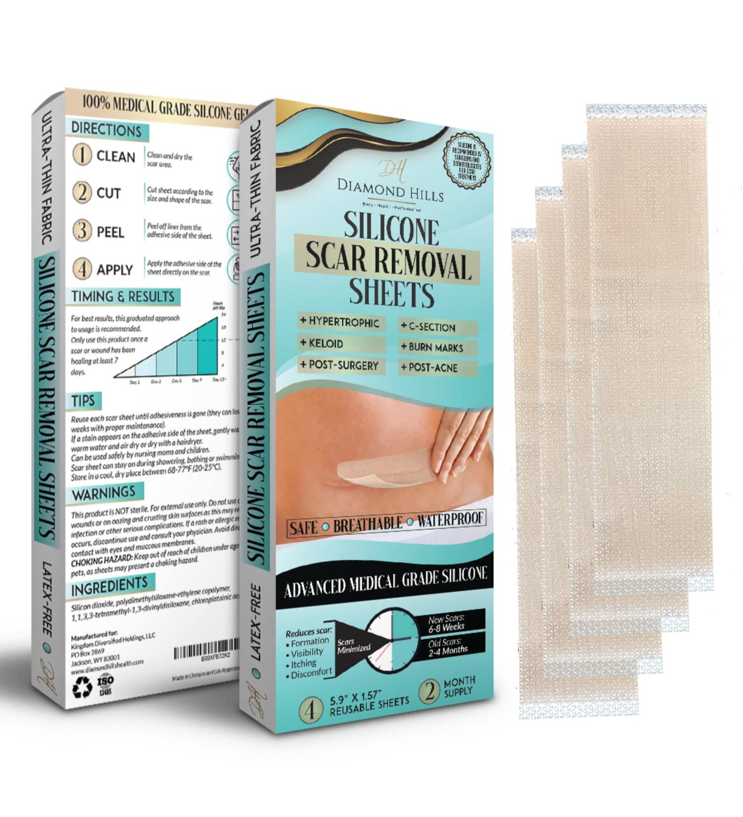 Diamond Hills Silicone Scar Removal Sheets - 4 Strips 5.9x1.57 - Fade, Flatten & Lighten Surgical Scars - Buy Online on GoSupps.com