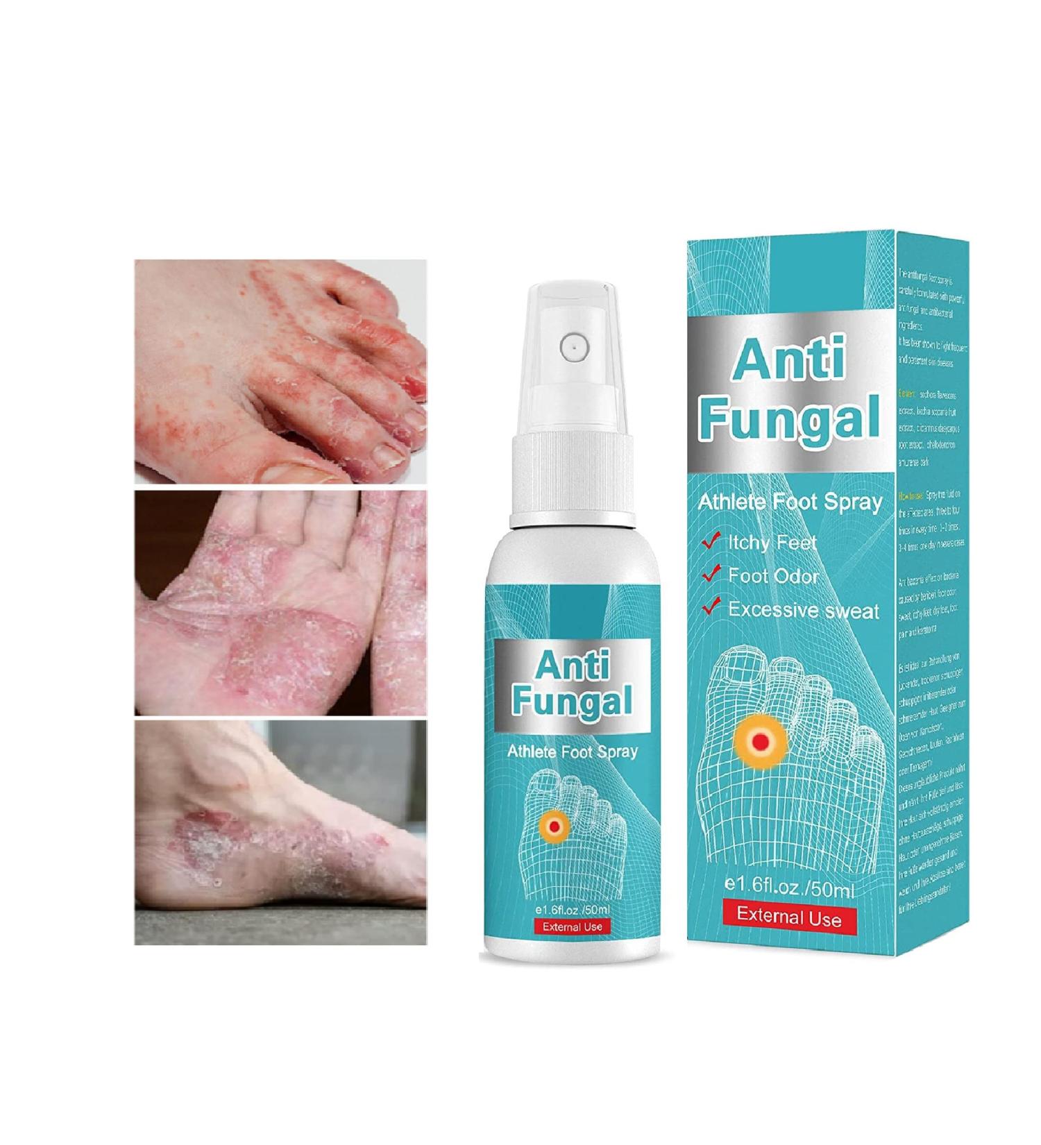 Natural Athlete's Foot Treatment Spray for Feet Itch, Sweat, Peeling & Blisters - Buy Online on GoSupps.com