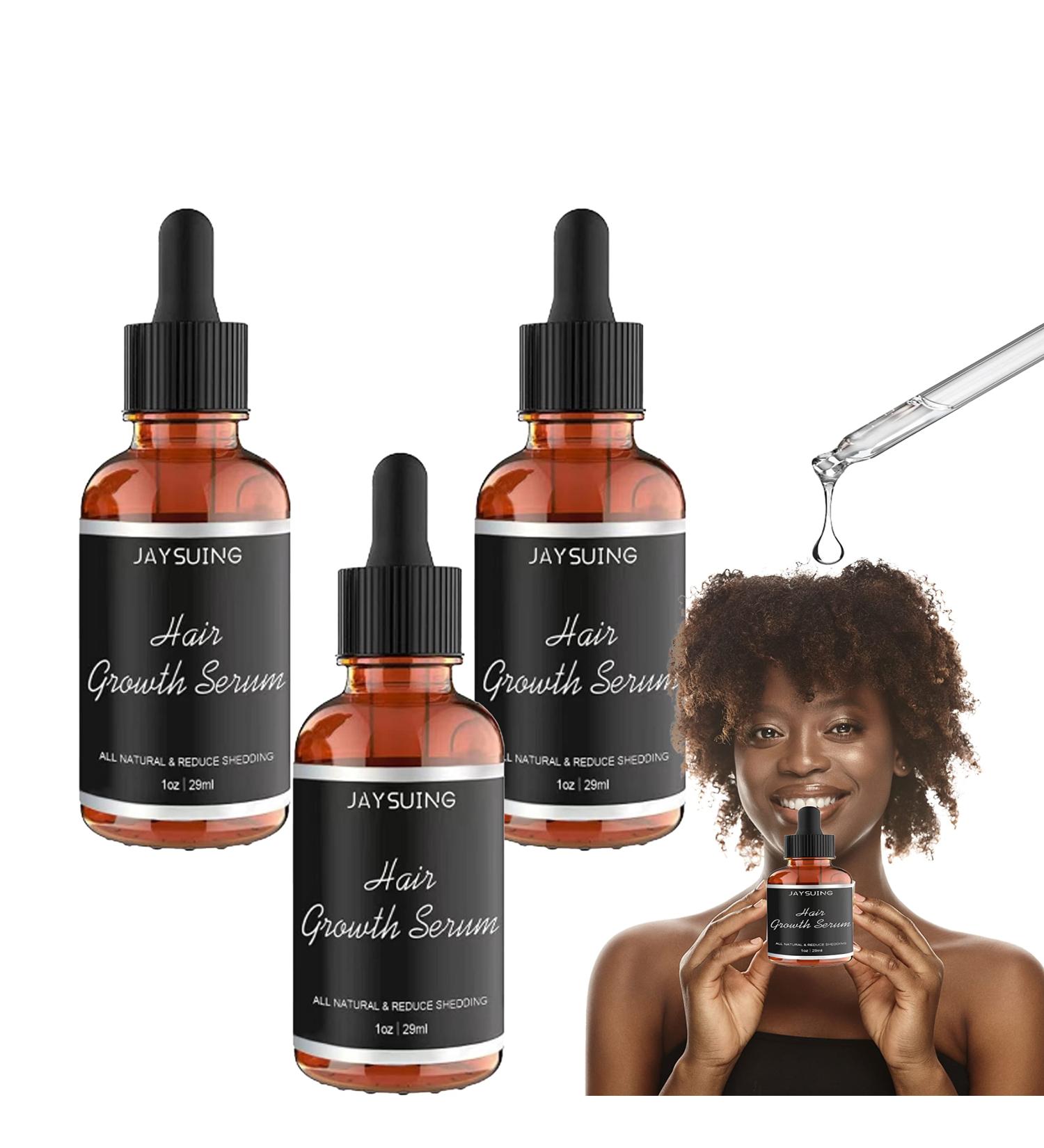2023 New Allurium Hair Growth Serum for Black Women - Nourish, Repair, and Stimulate Fast Natural Hair Growth (3 Pcs) - Buy Online on GoSupps.com