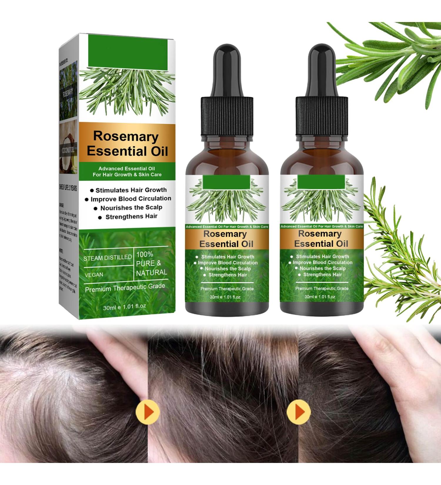 Organic Rosemary Castor Hair Oil & Scalp Strengthening Hair Growth Oil Stimulates Hair Growth Improves Circulation 30ml (2pc) - Buy Online on GoSupps.com