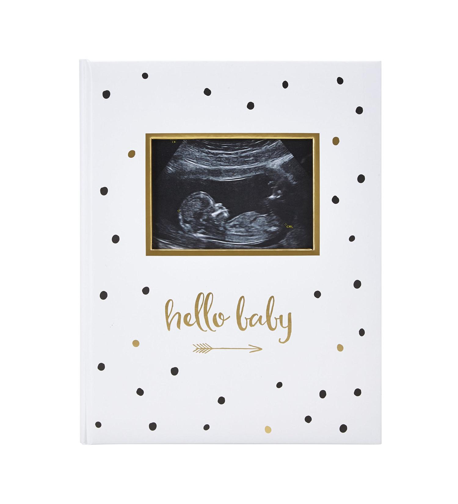 Pearhead First 5 Years Baby Memory Book - Gender-Neutral Baby Keepsake - Black and Gold Polka Dot Design - Perfect Gift for New Parents - Includes Hello Baby Sonogram Book - 1 Count - Buy Online on GoSupps.com