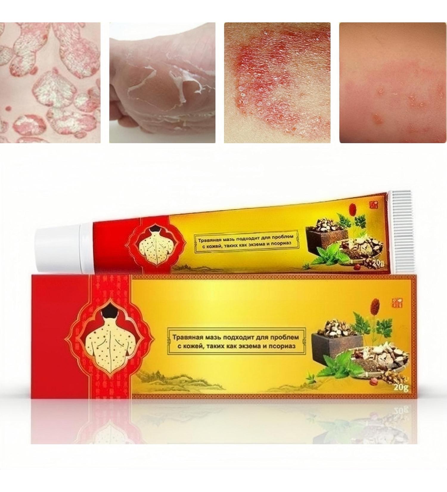 Face Cream Body Cream Anti-Itch Cream Chinese Herbal Cream Skin Repairing Cream for Face Body Healthy Skin Treatment Antifungal Cream Treatment Ointment Cream for Itchy Skin Moisturizing Skin Cream - Buy Online on GoSupps.com