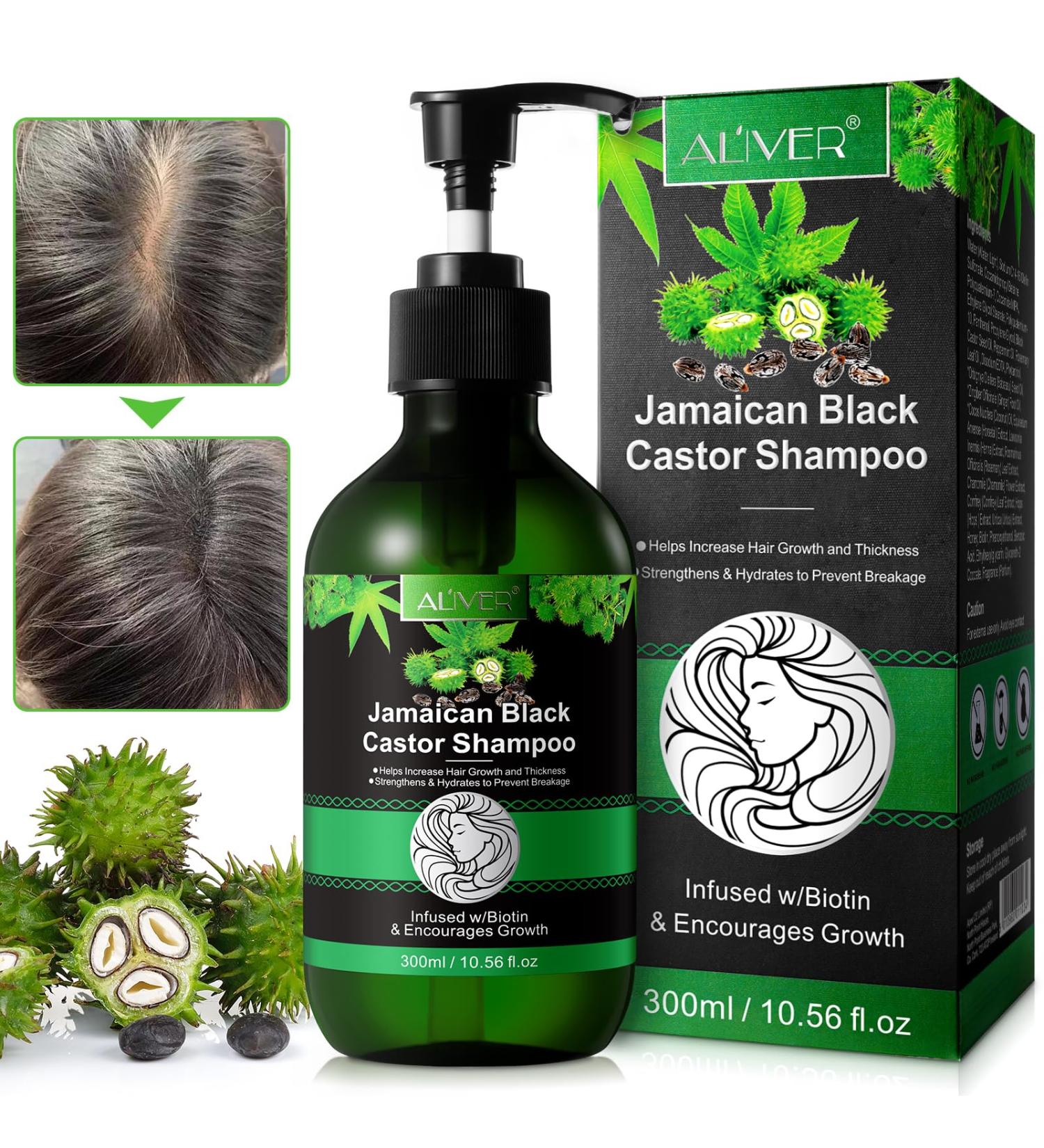 Valleylux Jamaican Black Castor Oil Shampoo Shampoo for Hair Growth Organic Against Loss with Biotin Deep Cleansing Repairing and Moisturising Women Men 300 ml - Buy Online on GoSupps.com