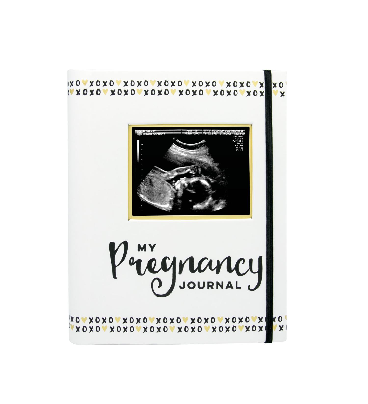 Pearhead Pregnancy Journal & Keepsake Book - Gender Neutral Memories Album for Baby Boy or Girl - Black and White Design - 1 Count - Buy Online on GoSupps.com