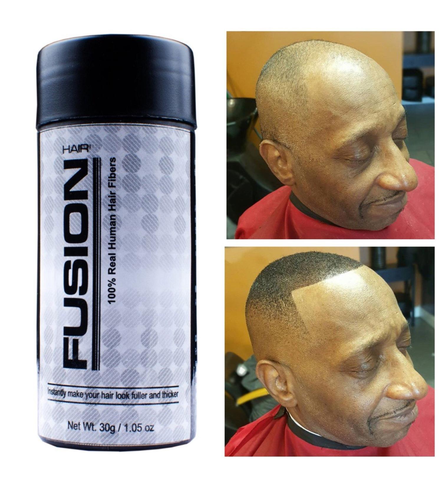 HAIR FUSION - Real Human Hair Fibers for Baldness & Thinning Hair - Root Touch Up, Volumizer - Unisex (Jet Black 1.05 oz) - Buy Online on GoSupps.com