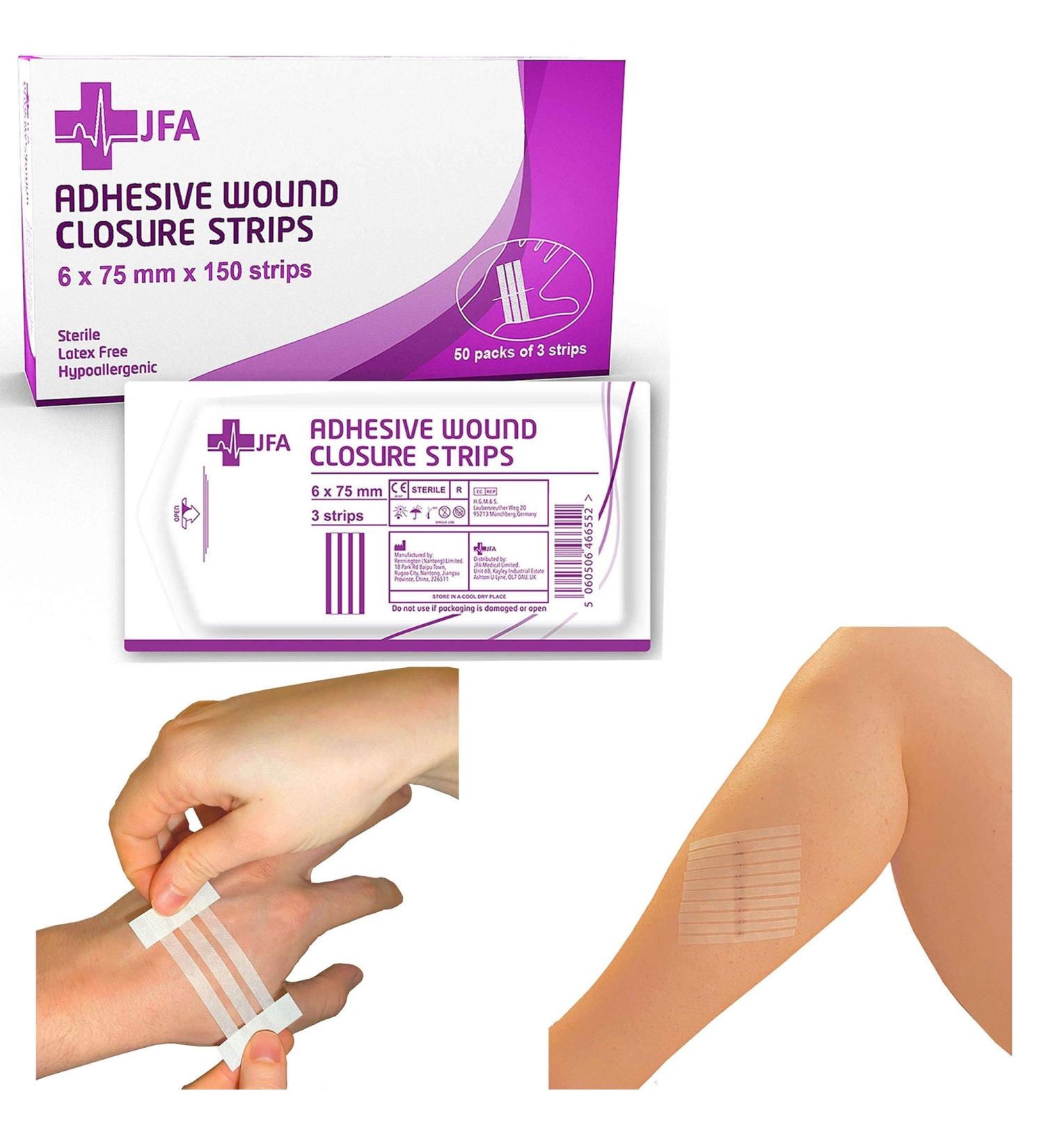 JFA Medical Set of 150 Wound Closure Strips - Staple Plasters & Suture Material (6x75mm) | International Shipping Available - Buy Online on GoSupps.com