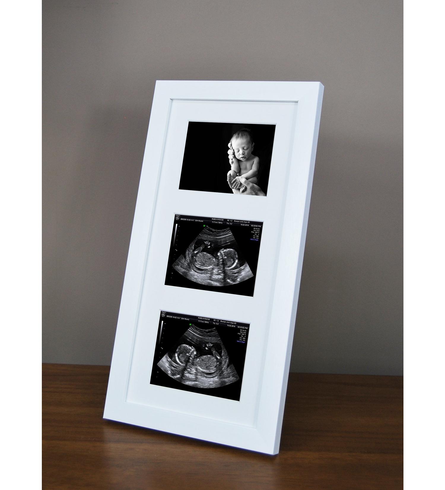 SignatureFrames Baby Scan Photo Frame. Triple ultrasound scan frame in gloss white.