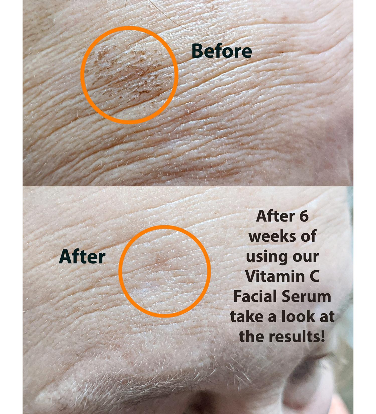 Buy Vitamin C Serum 1 oz | Anti-Aging Skin Brightener with Hyaluronic Acid & Collagen Peptides - International Shipping - Buy Online on GoSupps.com