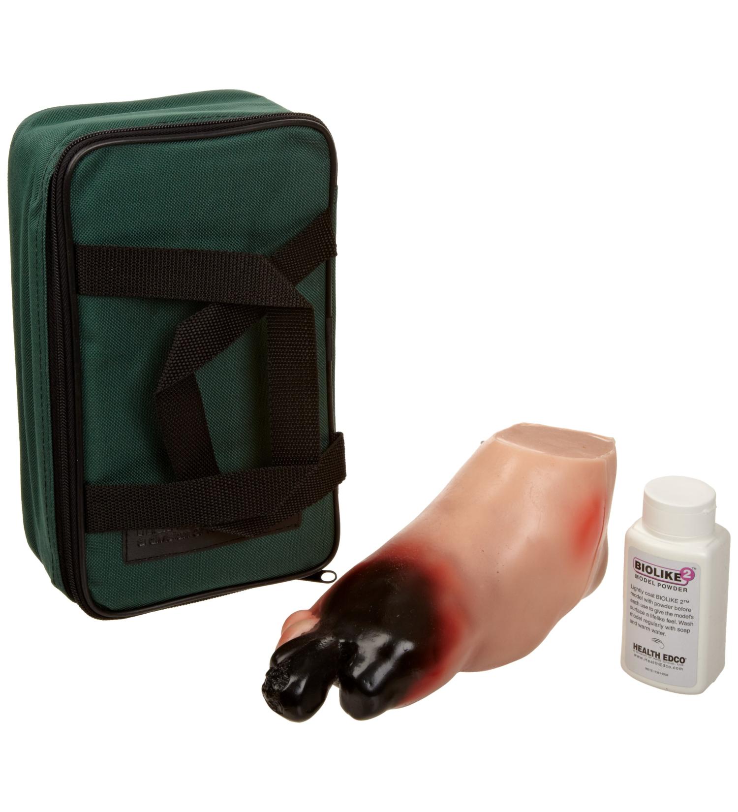 HEALTH EDCO W43107A Biolike Severe Diabetic Foot Model