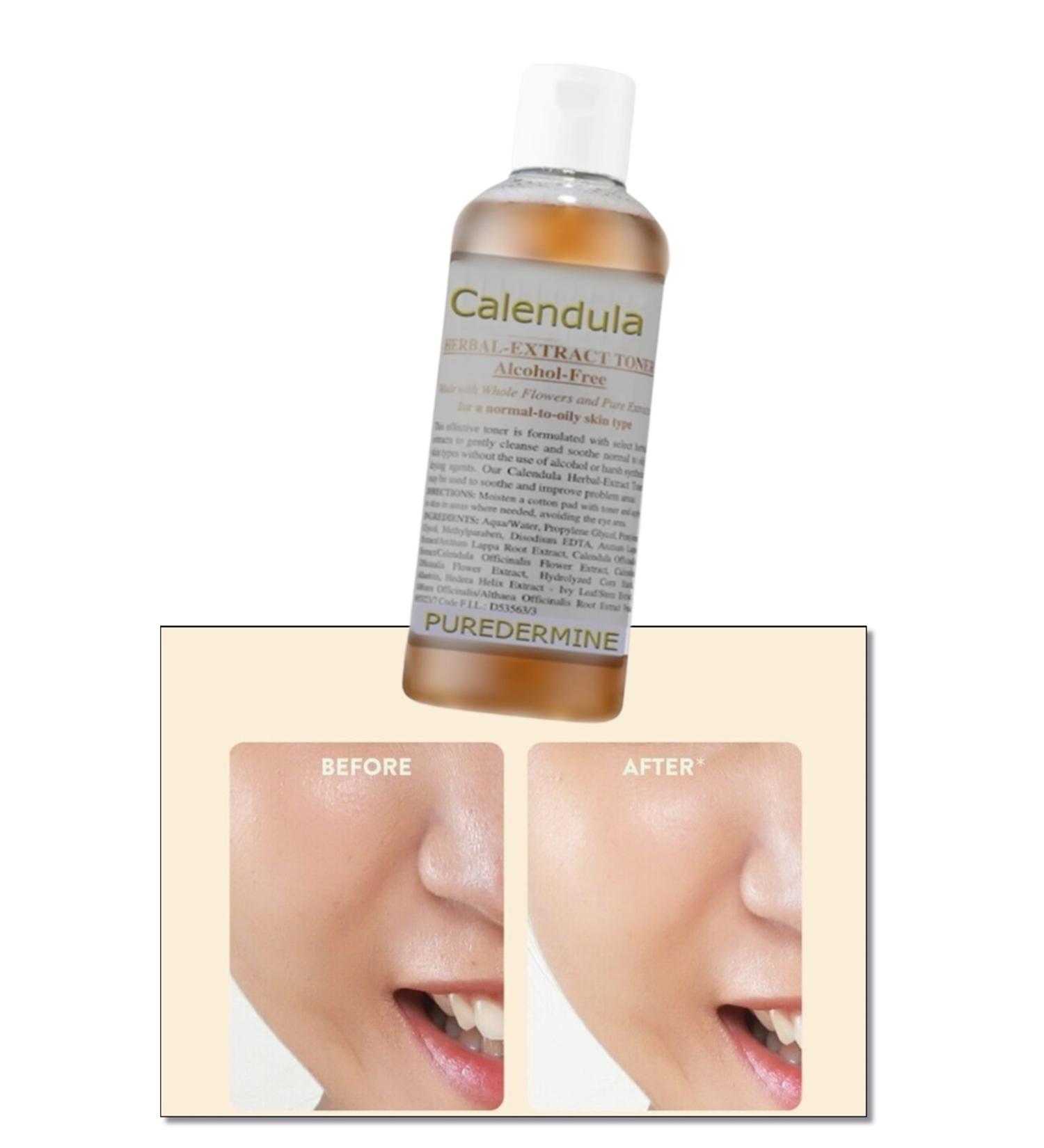 Puredermine Chamomile & Calendula Pore Facial Toner & Balancing Face Toner & Herbal Content - Buy Online on GoSupps.com