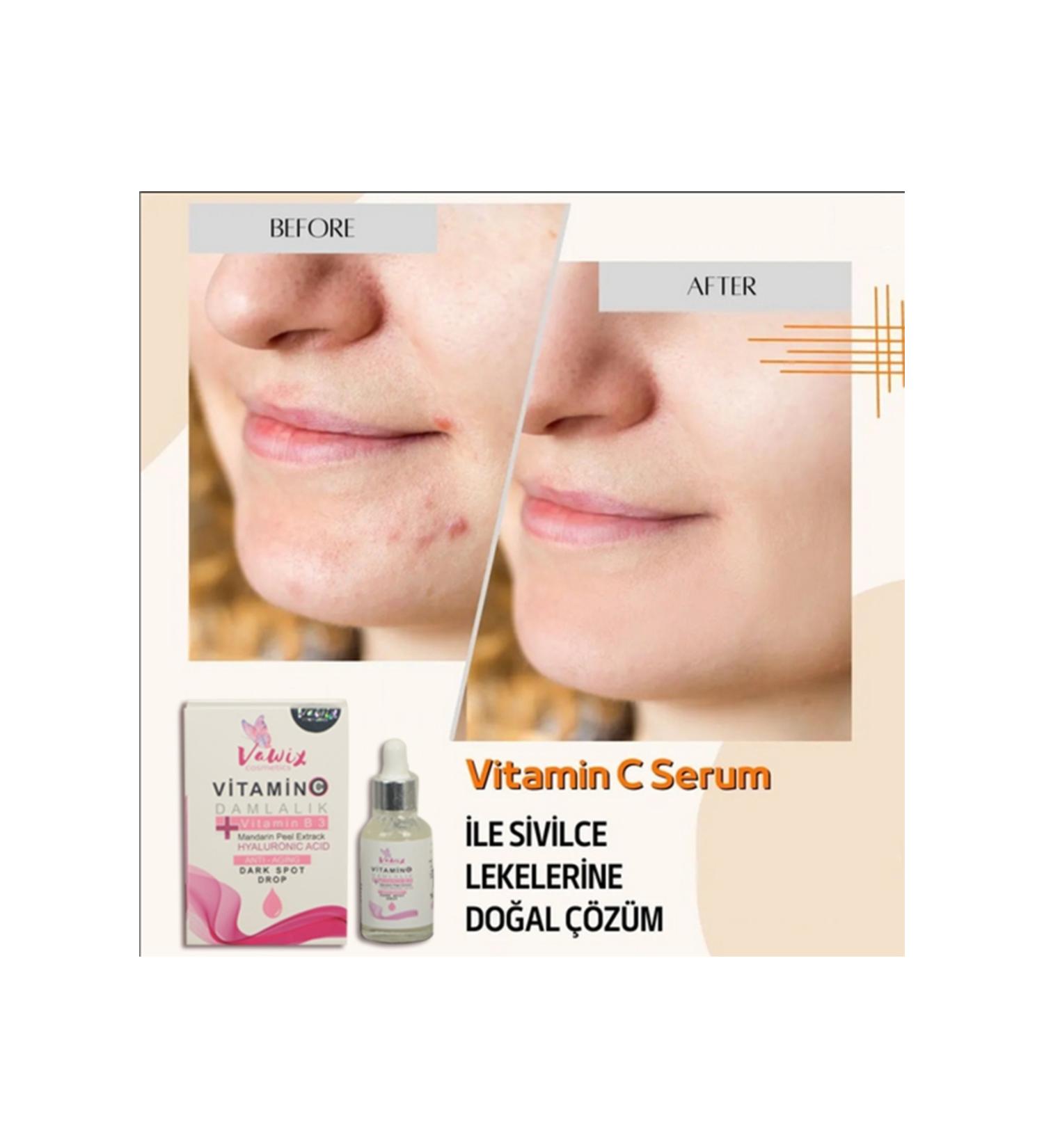 Vawix Vitamin C Serum Anti-Dark Spots and Wrinkles
