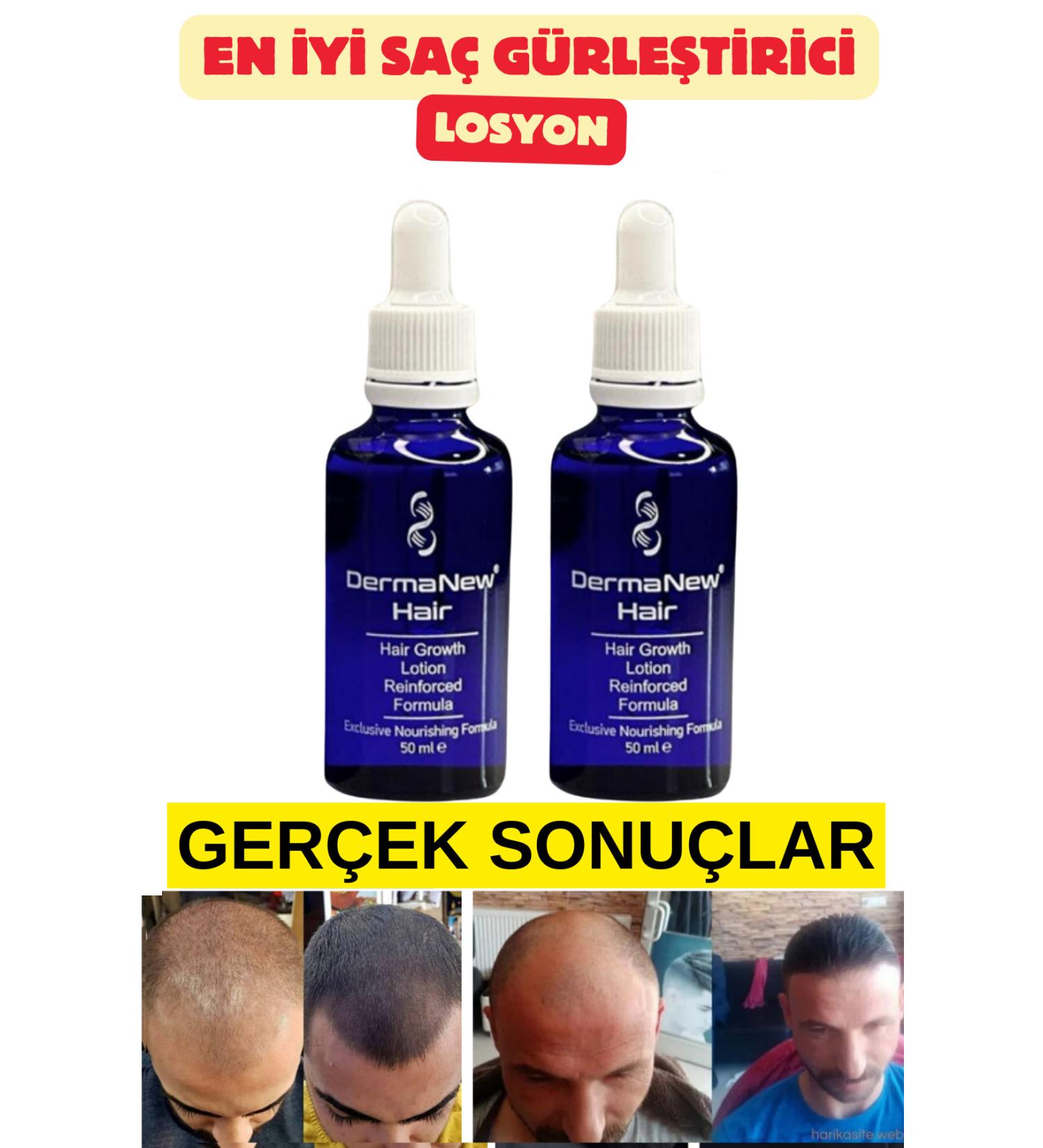 Dermanew Hair Hair Care Set Hair Serum Oil - Hair / 2 Pieces - Buy Online on GoSupps.com