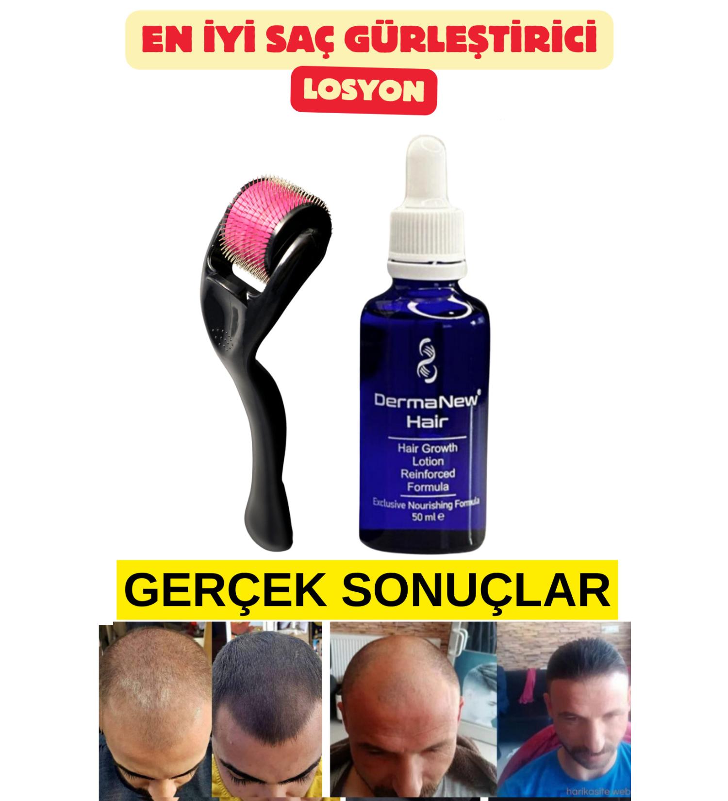 dermanew hair Hair Care Set - Hair Care Hair Serum and Oil - Hair / 1 Piece Roller - Buy Online on GoSupps.com