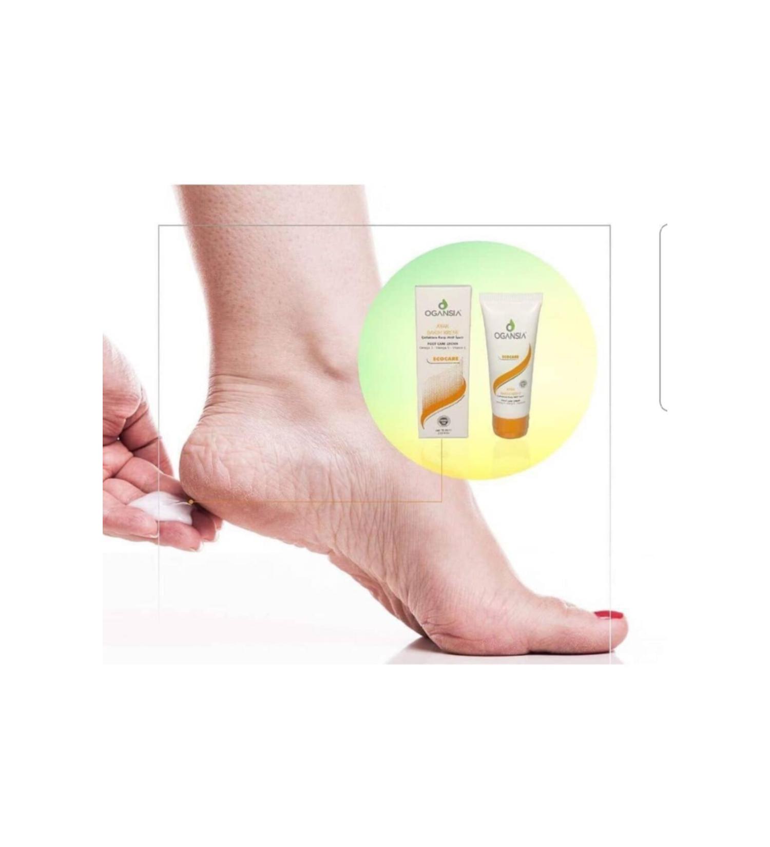 Naturaled Anti-Crack Foot Care Cream-anti crack