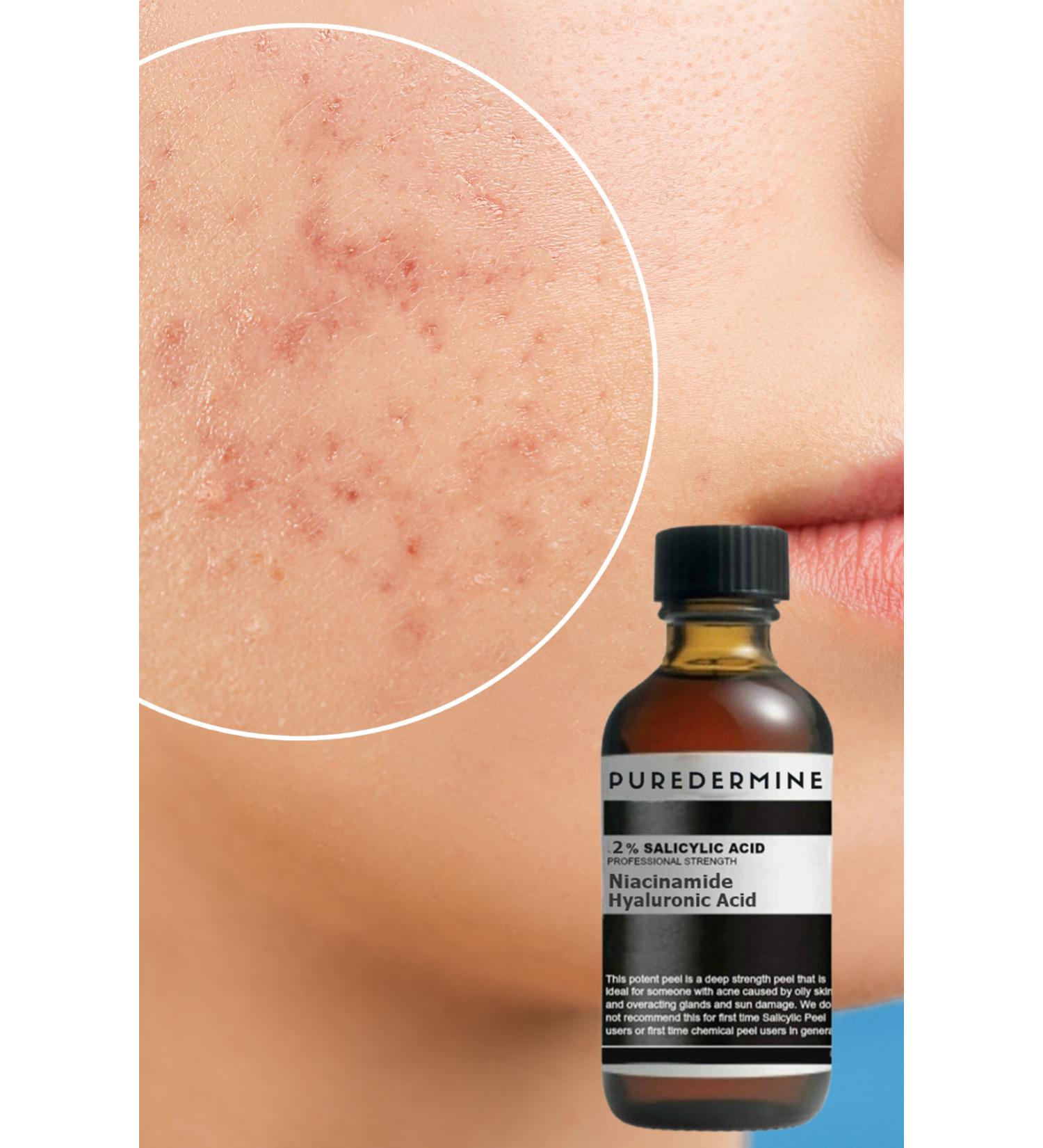 Puredermine Salicylic Acid & Dull Clogged Pores & Blackheads & Acne Serum & Niacinamide + Ha - Buy Online on GoSupps.com