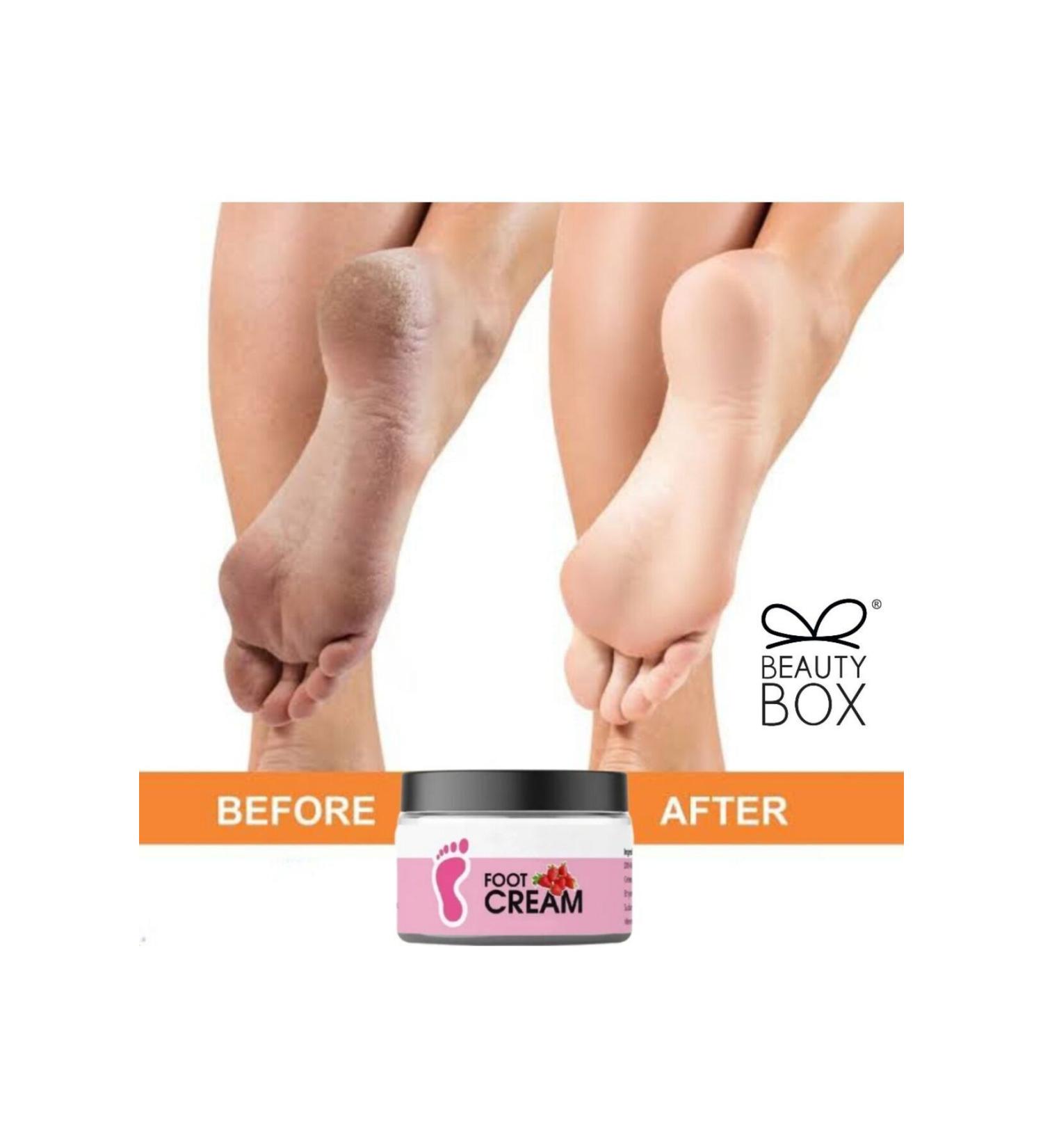 Beauty Box Anti-Fungus Protection Bad Odor Preventive Heel Crack Gel Premium Foot Cream