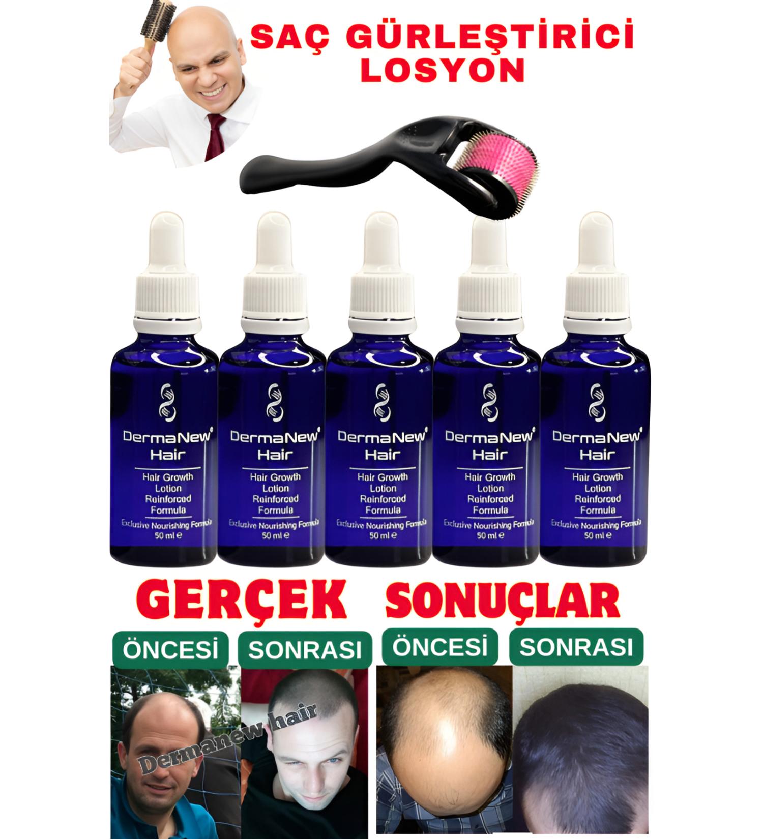dermanew hair Dermanew Hair Lotion Hair Care Oil - Hair Thickener - Hair Serum / 5 Pieces Roller - Buy Online on GoSupps.com