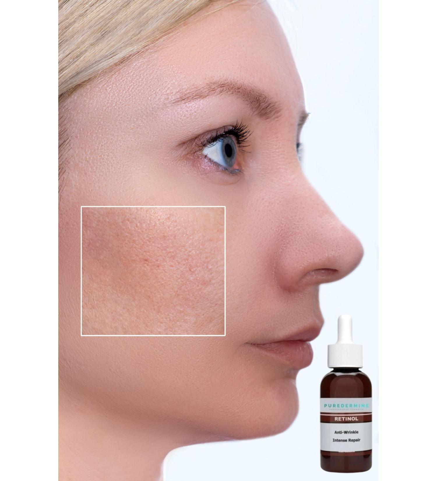 Puredermine Large Size 50ml Retinol 2.5% Face Serum Face Crepe Erase & Dark Spots & Pores & Fine Lines - Buy Online on GoSupps.com