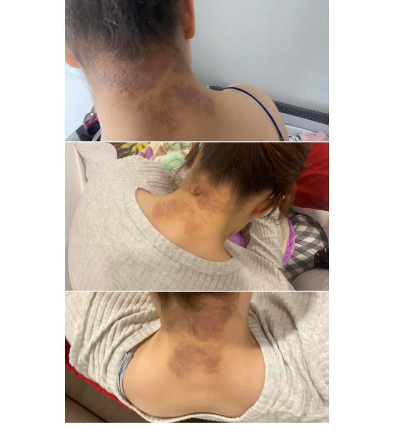 Wien 0 Natural Eczema Cream 150 ml