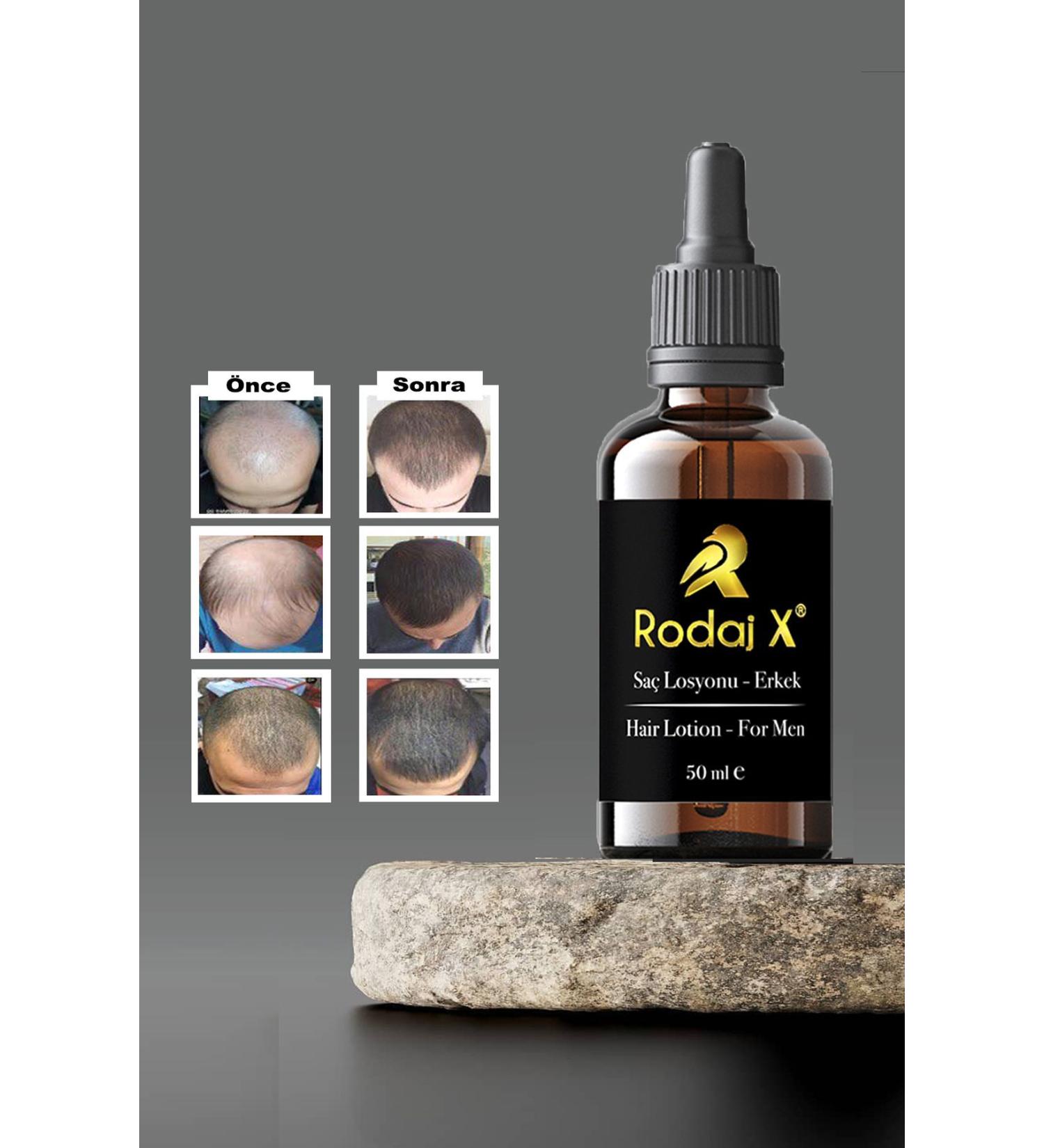Rodaj X Men's Hair Growth Serum - Nourishes Strengthens Accelerates Hair Growth - Buy Online on GoSupps.com