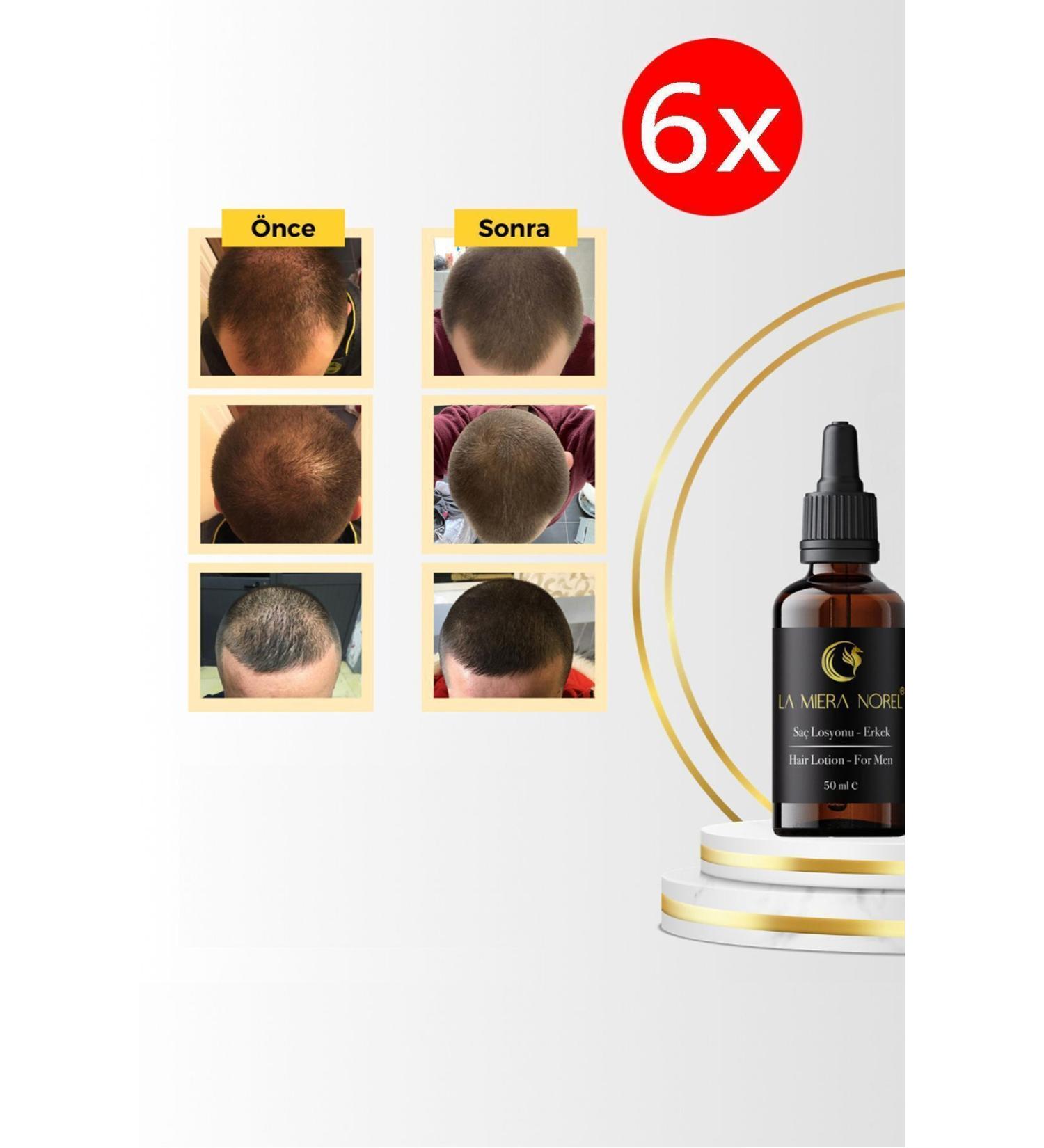La Miera Norel 6 Men's Hair Growth Serum - Nourishes Strengthens Accelerates Hair Growth