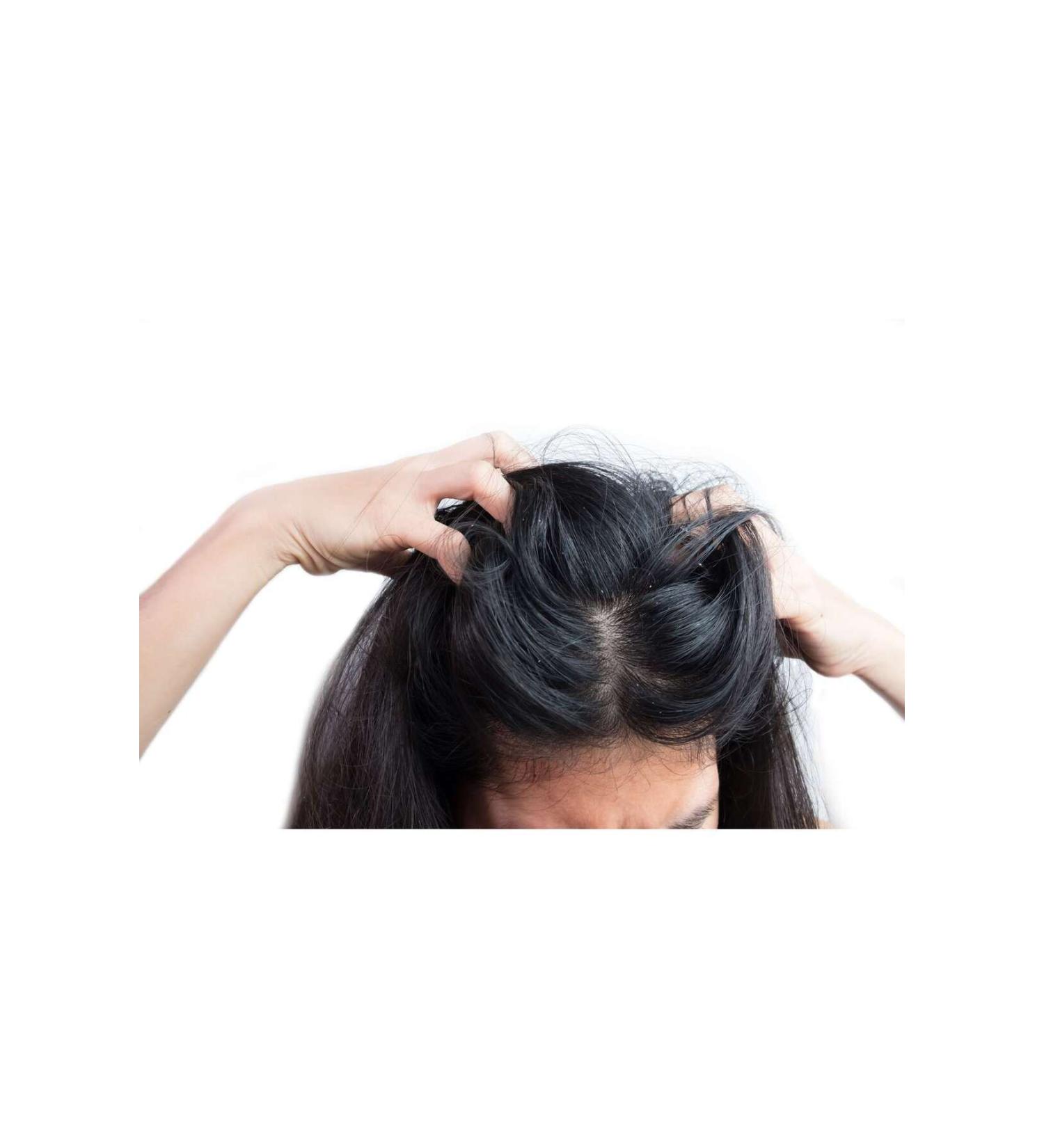 Cabi La'lus Mille Care Oil for Eczema and Dandruff Hair