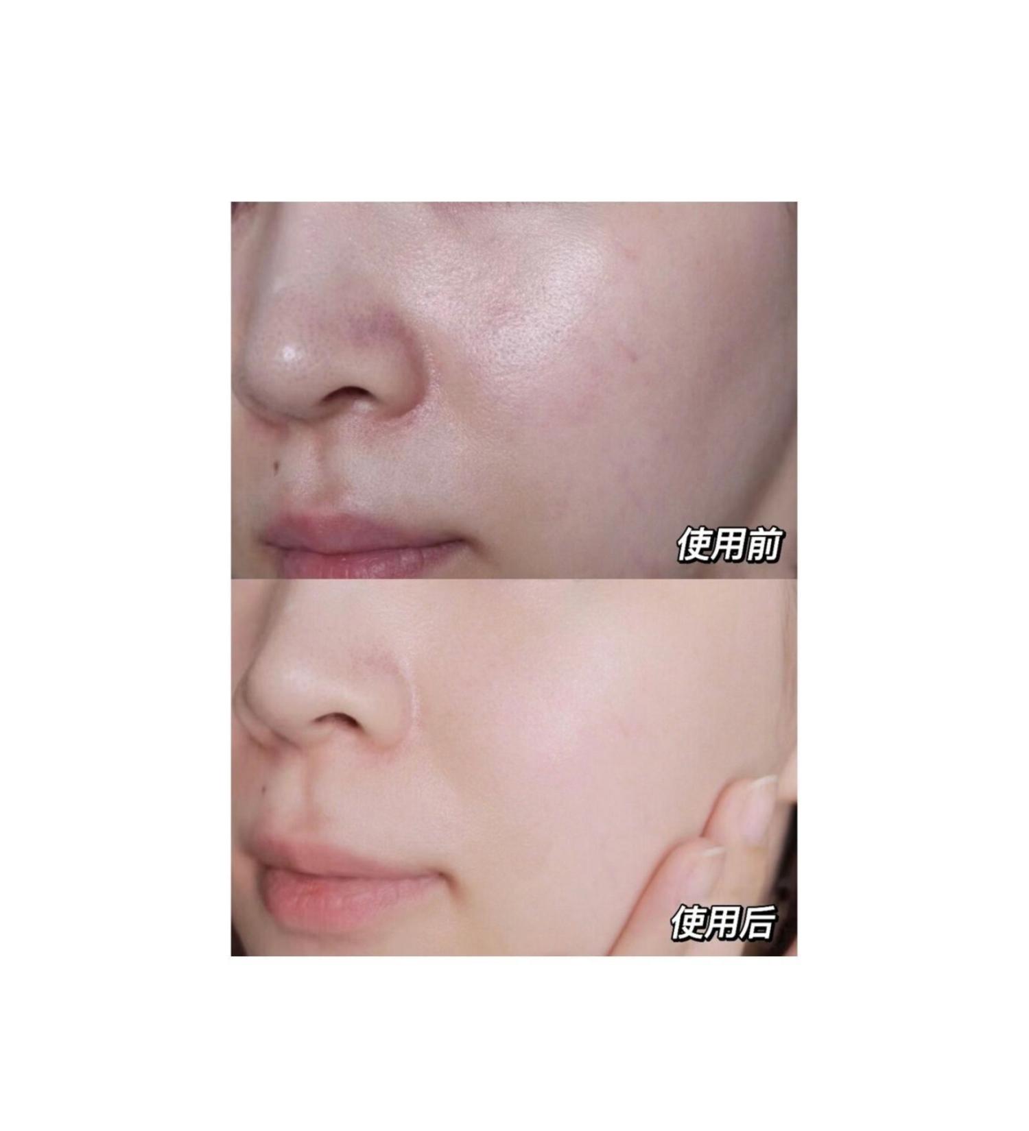 MACK ANDY Anti-Wrinkle and Capillary Redness